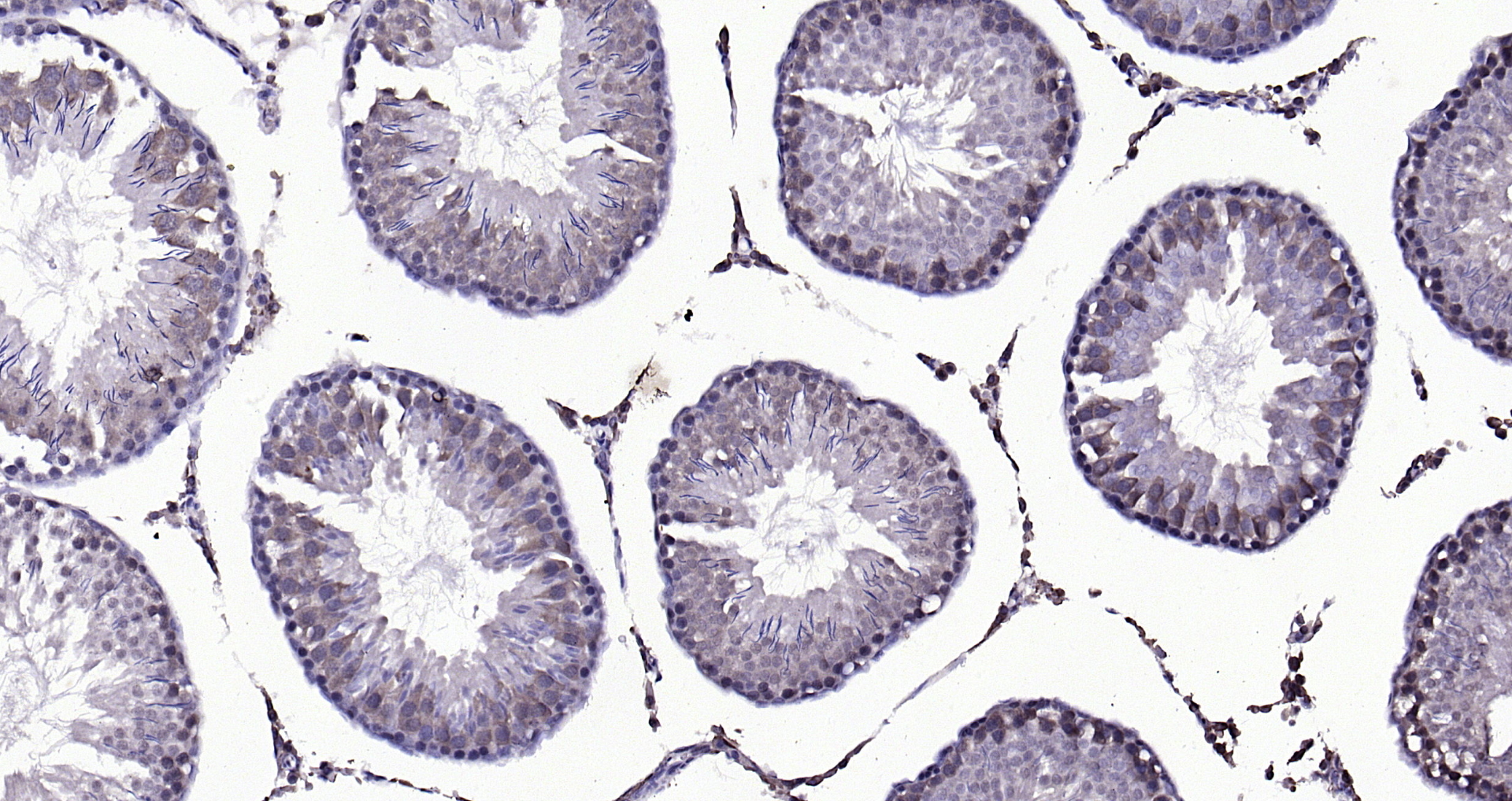 Paraformaldehyde-fixed, paraffin embedded (rat testis); Antigen retrieval by boiling in sodium citrate buffer (pH6.0) for 15min; Block endogenous peroxidase by 3% hydrogen peroxide for 20 minutes; Blocking buffer (normal goat serum) at 37°C for 30min; Antibody incubation with (Beta arrestin 2) Polyclonal Antibody, Unconjugated (bs-1332R) at 1:200 overnight at 4°C, followed by operating according to SP Kit(Rabbit) (sp-0023) instructionsand DAB staining. Paraformaldehyde-fixed, paraffin embedded (rat testis); Antigen retrieval by boiling in sodium citrate buffer (pH6.0) for 15min; Block endogenous peroxidase by 3% hydrogen peroxide for 20 minutes; Blocking buffer (normal goat serum) at 37°C for 30min; Antibody incubation with (Beta arrestin 2) Polyclonal Antibody, Unconjugated (bs-1332R) at 1:200 overnight at 4°C, followed by operating according to SP Kit(Rabbit) (sp-0023) instructionsand DAB staining.