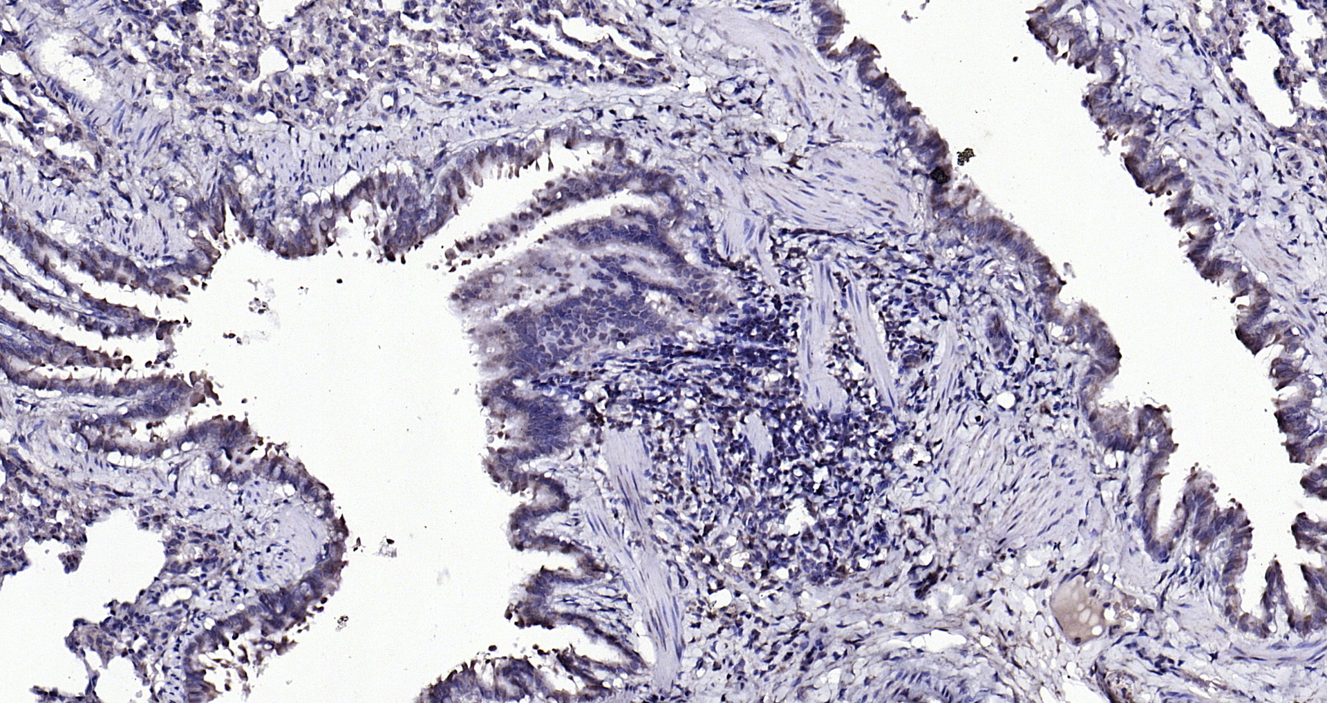 Paraformaldehyde-fixed, paraffin embedded (rat lung); Antigen retrieval by boiling in sodium citrate buffer (pH6.0) for 15min; Block endogenous peroxidase by 3% hydrogen peroxide for 20 minutes; Blocking buffer (normal goat serum) at 37°C for 30min; Antibody incubation with (Beta arrestin 2) Polyclonal Antibody, Unconjugated (bs-1332R) at 1:200 overnight at 4°C, followed by operating according to SP Kit(Rabbit) (sp-0023) instructionsand DAB staining. Paraformaldehyde-fixed, paraffin embedded (rat lung); Antigen retrieval by boiling in sodium citrate buffer (pH6.0) for 15min; Block endogenous peroxidase by 3% hydrogen peroxide for 20 minutes; Blocking buffer (normal goat serum) at 37°C for 30min; Antibody incubation with (Beta arrestin 2) Polyclonal Antibody, Unconjugated (bs-1332R) at 1:200 overnight at 4°C, followed by operating according to SP Kit(Rabbit) (sp-0023) instructionsand DAB staining.