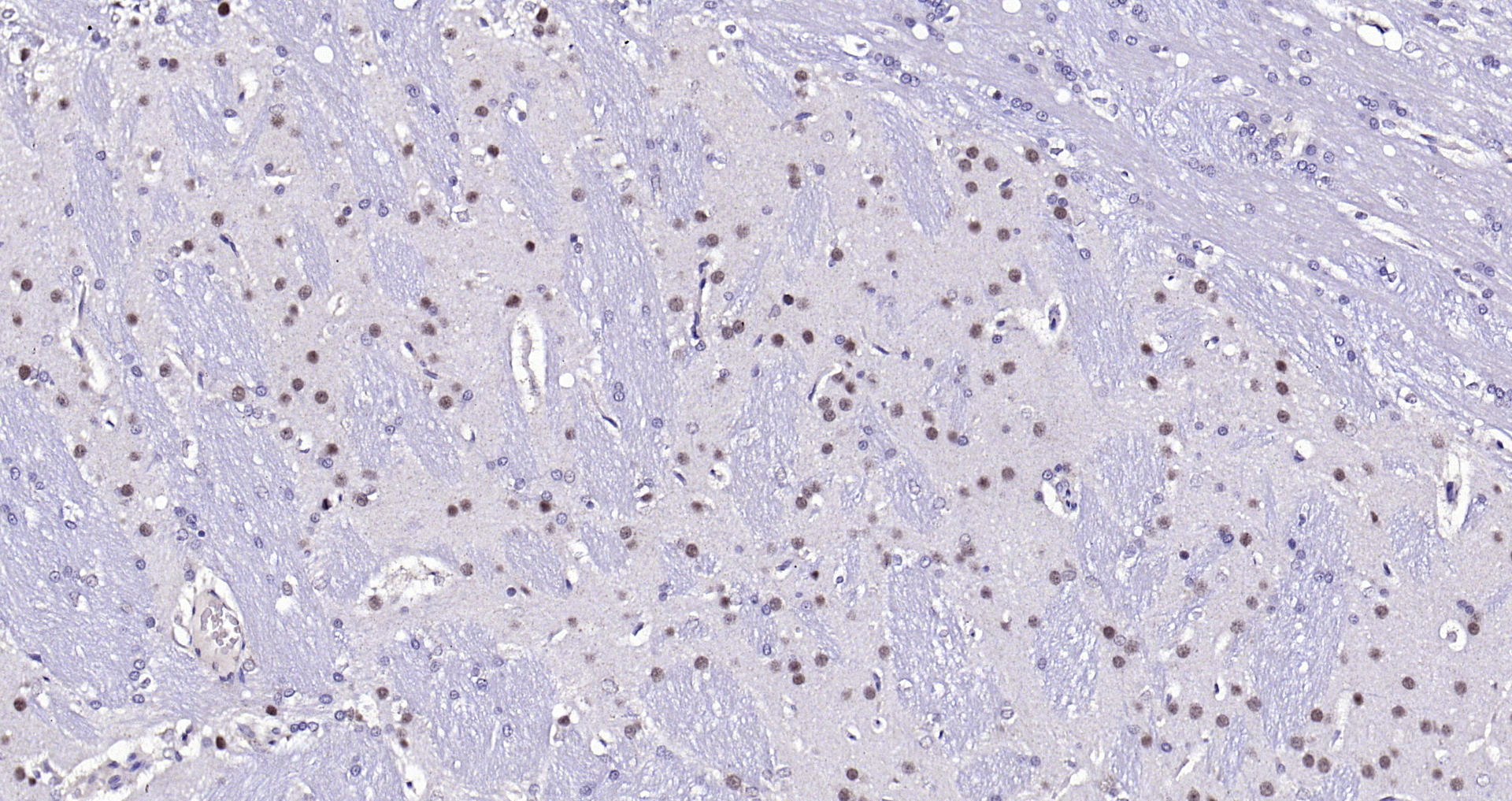 Paraformaldehyde-fixed, paraffin embedded (rat brain); Antigen retrieval by boiling in sodium citrate buffer (pH6.0) for 15min; Block endogenous peroxidase by 3% hydrogen peroxide for 20 minutes; Blocking buffer (normal goat serum) at 37°C for 30min; Antibody incubation with (Beta arrestin 2) Polyclonal Antibody, Unconjugated (bs-1332R) at 1:200 overnight at 4°C, followed by operating according to SP Kit(Rabbit) (sp-0023) instructionsand DAB staining. Paraformaldehyde-fixed, paraffin embedded (rat brain); Antigen retrieval by boiling in sodium citrate buffer (pH6.0) for 15min; Block endogenous peroxidase by 3% hydrogen peroxide for 20 minutes; Blocking buffer (normal goat serum) at 37°C for 30min; Antibody incubation with (Beta arrestin 2) Polyclonal Antibody, Unconjugated (bs-1332R) at 1:200 overnight at 4°C, followed by operating according to SP Kit(Rabbit) (sp-0023) instructionsand DAB staining.