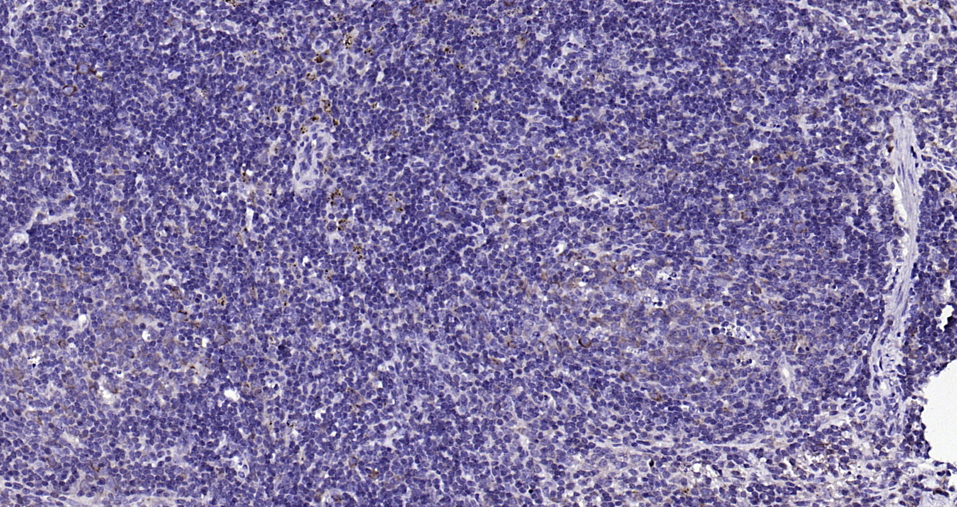 Paraformaldehyde-fixed, paraffin embedded (mouse spleen); Antigen retrieval by boiling in sodium citrate buffer (pH6.0) for 15min; Block endogenous peroxidase by 3% hydrogen peroxide for 20 minutes; Blocking buffer (normal goat serum) at 37°C for 30min; Antibody incubation with (Beta arrestin 2) Polyclonal Antibody, Unconjugated (bs-1332R) at 1:200 overnight at 4°C, followed by operating according to SP Kit(Rabbit) (sp-0023) instructionsand DAB staining. Paraformaldehyde-fixed, paraffin embedded (mouse spleen); Antigen retrieval by boiling in sodium citrate buffer (pH6.0) for 15min; Block endogenous peroxidase by 3% hydrogen peroxide for 20 minutes; Blocking buffer (normal goat serum) at 37°C for 30min; Antibody incubation with (Beta arrestin 2) Polyclonal Antibody, Unconjugated (bs-1332R) at 1:200 overnight at 4°C, followed by operating according to SP Kit(Rabbit) (sp-0023) instructionsand DAB staining.