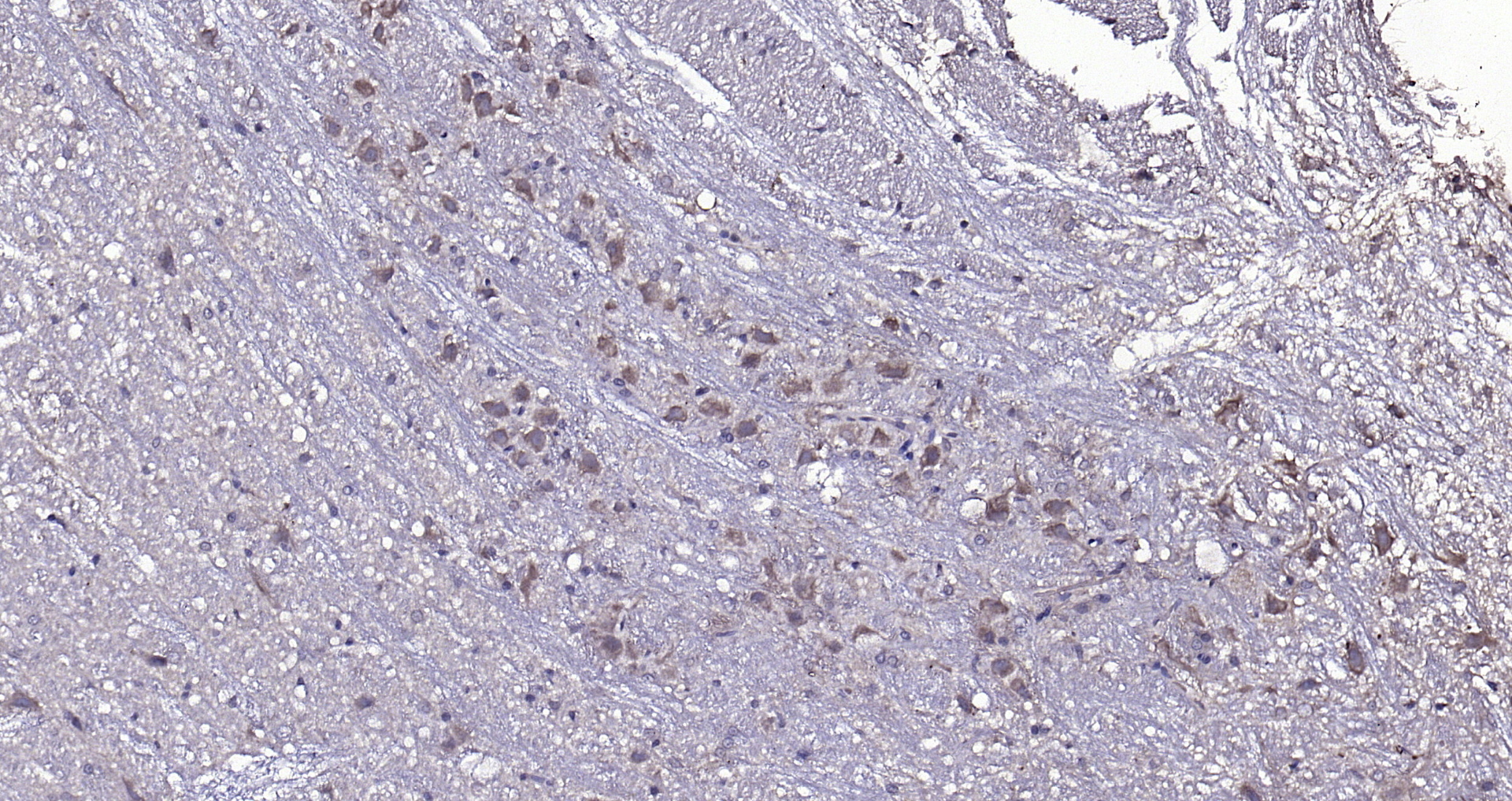 Paraformaldehyde-fixed, paraffin embedded (rat cerebellum); Antigen retrieval by boiling in sodium citrate buffer (pH6.0) for 15min; Block endogenous peroxidase by 3% hydrogen peroxide for 20 minutes; Blocking buffer (normal goat serum) at 37°C for 30min; Antibody incubation with (CKIP-1 ) Polyclonal Antibody, Unconjugated (bs-1330R) at 1:200 overnight at 4°C, followed by operating according to SP Kit(Rabbit) (sp-0023) instructionsand DAB staining. Paraformaldehyde-fixed, paraffin embedded (rat cerebellum); Antigen retrieval by boiling in sodium citrate buffer (pH6.0) for 15min; Block endogenous peroxidase by 3% hydrogen peroxide for 20 minutes; Blocking buffer (normal goat serum) at 37°C for 30min; Antibody incubation with (CKIP-1 ) Polyclonal Antibody, Unconjugated (bs-1330R) at 1:200 overnight at 4°C, followed by operating according to SP Kit(Rabbit) (sp-0023) instructionsand DAB staining.