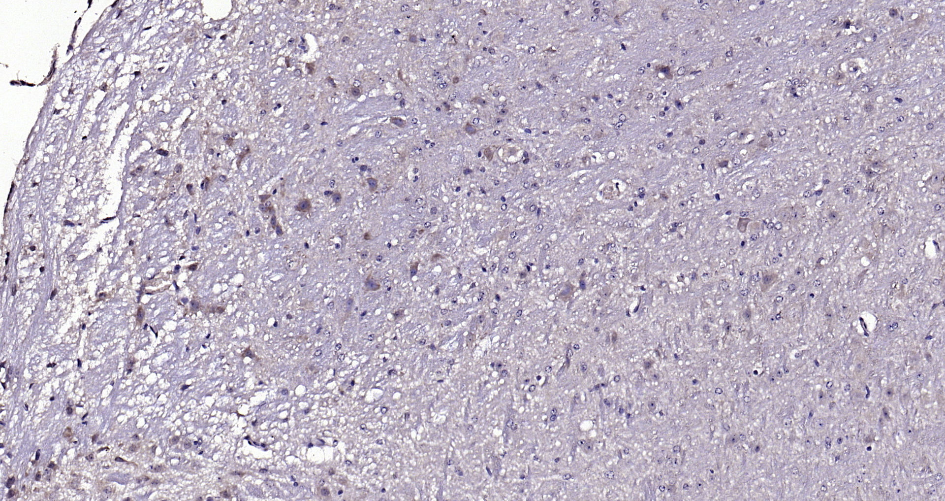 Paraformaldehyde-fixed, paraffin embedded (mouse cerebellum); Antigen retrieval by boiling in sodium citrate buffer (pH6.0) for 15min; Block endogenous peroxidase by 3% hydrogen peroxide for 20 minutes; Blocking buffer (normal goat serum) at 37°C for 30min; Antibody incubation with (CKIP-1 ) Polyclonal Antibody, Unconjugated (bs-1330R) at 1:200 overnight at 4°C, followed by operating according to SP Kit(Rabbit) (sp-0023) instructionsand DAB staining. Paraformaldehyde-fixed, paraffin embedded (mouse cerebellum); Antigen retrieval by boiling in sodium citrate buffer (pH6.0) for 15min; Block endogenous peroxidase by 3% hydrogen peroxide for 20 minutes; Blocking buffer (normal goat serum) at 37°C for 30min; Antibody incubation with (CKIP-1 ) Polyclonal Antibody, Unconjugated (bs-1330R) at 1:200 overnight at 4°C, followed by operating according to SP Kit(Rabbit) (sp-0023) instructionsand DAB staining.