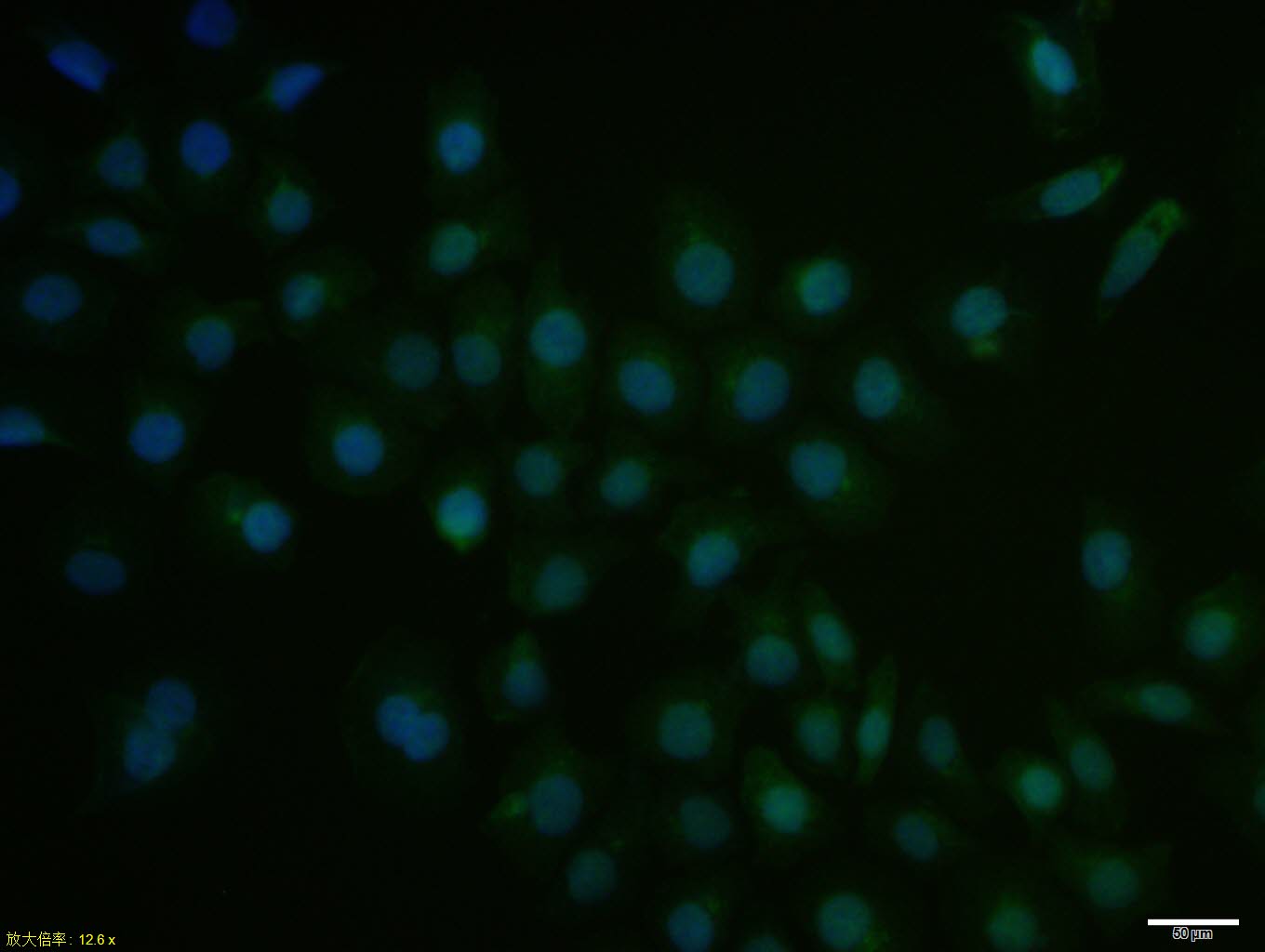 HepG2 cell; 4% Paraformaldehyde-fixed; Triton X-100 at room temperature for 20 min; Blocking buffer (normal goat serum, C-0005) at 37°C for 20 min; Antibody incubation with (SMAD5) polyclonal Antibody, Unconjugated (bs-13890R) 1:100, 90 minutes at 37°C; followed by a conjugated Goat Anti-Rabbit IgG antibody at 37°C for 90 minutes, DAPI (blue, C02-04002) was used to stain the cell nuclei.