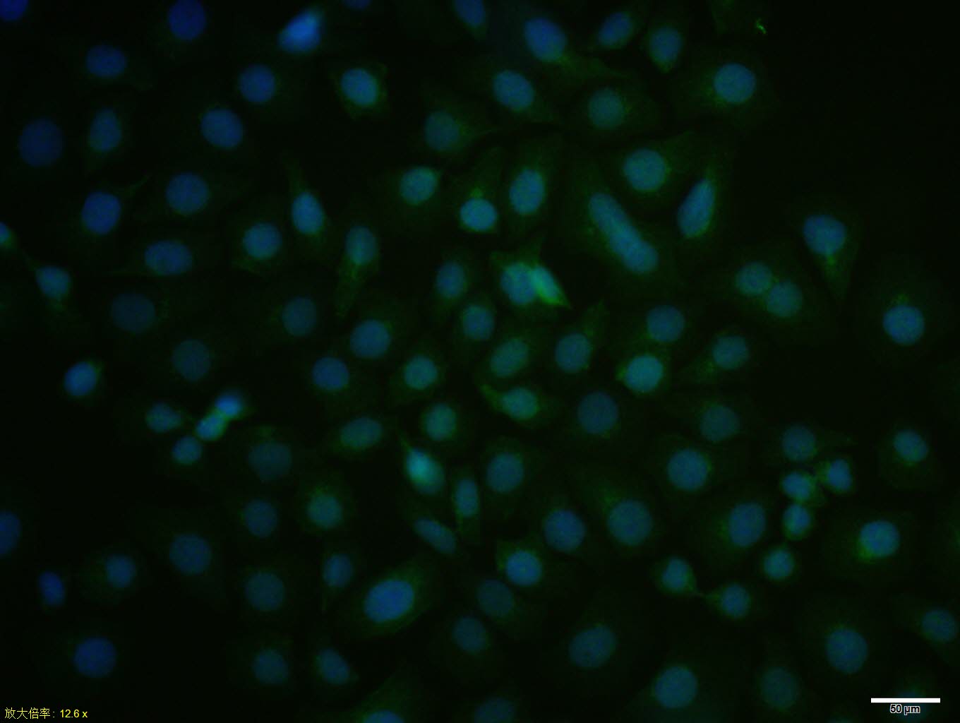 HepG2 cell; 4% Paraformaldehyde-fixed; Triton X-100 at room temperature for 20 min; Blocking buffer (normal goat serum, C-0005) at 37°C for 20 min; Antibody incubation with (Cyclin G) polyclonal Antibody, Unconjugated (bs-1389R) 1:100, 90 minutes at 37°C; followed by a conjugated Goat Anti-Rabbit IgG antibody at 37°C for 90 minutes, DAPI (blue, C02-04002) was used to stain the cell nuclei.