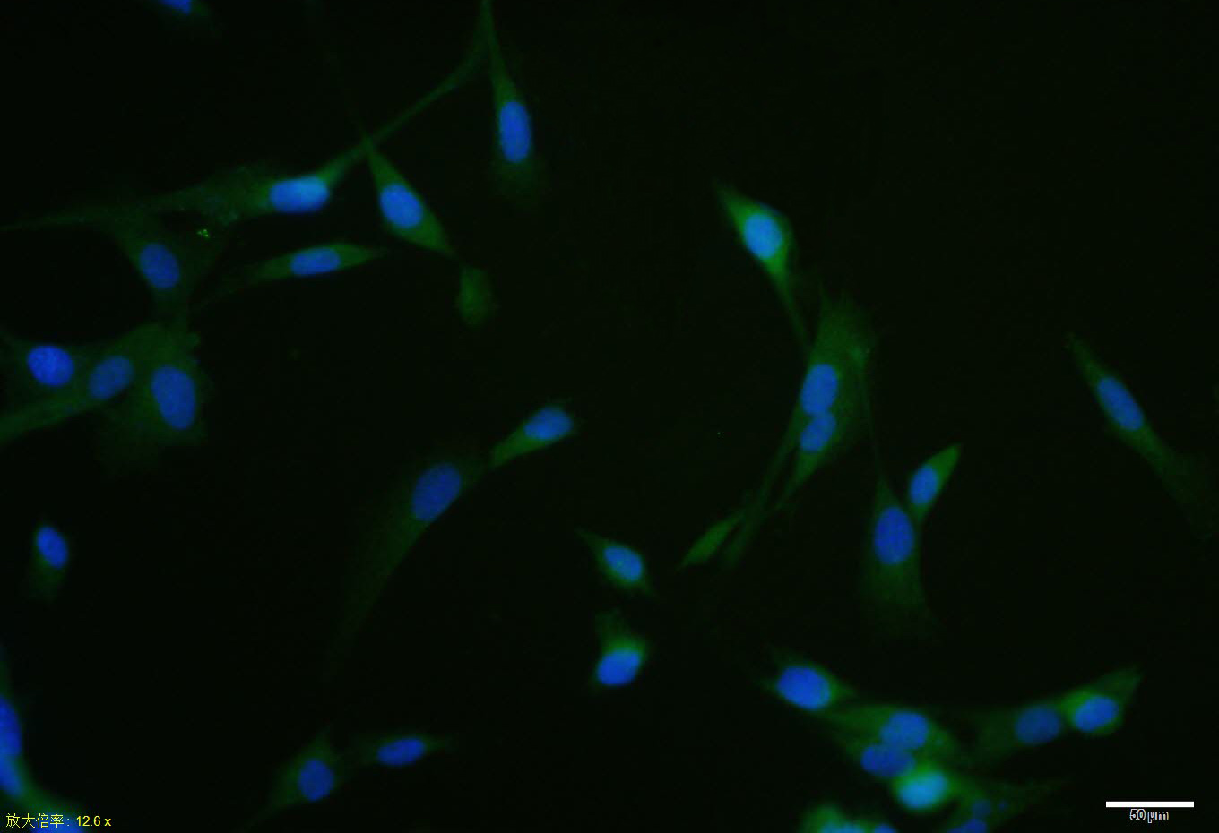 U87MG cell; 4% Paraformaldehyde-fixed; Triton X-100 at room temperature for 20 min; Blocking buffer (normal goat serum, C-0005) at 37°C for 20 min; Antibody incubation with (RAR Beta) polyclonal Antibody, Unconjugated (bs-0516R) 1:100, 90 minutes at 37°C; followed by a conjugated Goat Anti-Rabbit IgG antibody at 37°C for 90 minutes, DAPI (blue, C02-04002) was used to stain the cell nuclei
