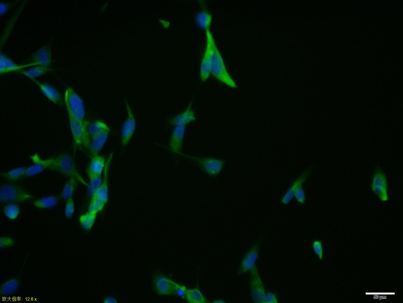 U87MG cell; 4% Paraformaldehyde-fixed; Triton X-100 at room temperature for 20 min; Blocking buffer (normal goat serum, C-0005) at 37°C for 20 min; Antibody incubation with (CHI3L1) polyclonal Antibody, Unconjugated (bs-1093R) 1:100, 90 minutes at 37°C; followed by a conjugated Goat Anti-Rabbit IgG antibody at 37°C for 90 minutes, DAPI (blue, C02-04002) was used to stain the cell nuclei.