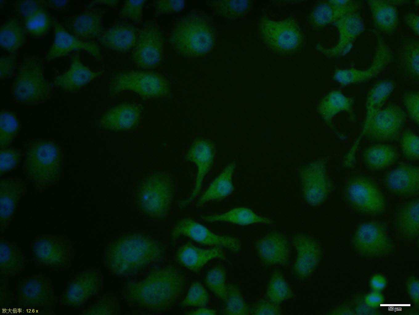 HepG2 cell; 4% Paraformaldehyde-fixed; Triton X-100 at room temperature for 20 min; Blocking buffer (normal goat serum, C-0005) at 37°C for 20 min; Antibody incubation with (HSP90 beta) polyclonal Antibody, Unconjugated (bs-0135R) 1:100, 90 minutes at 37°C; followed by a conjugated Goat Anti-Rabbit IgG antibody at 37°C for 90 minutes, DAPI (blue, C02-04002) was used to stain the cell nuclei.