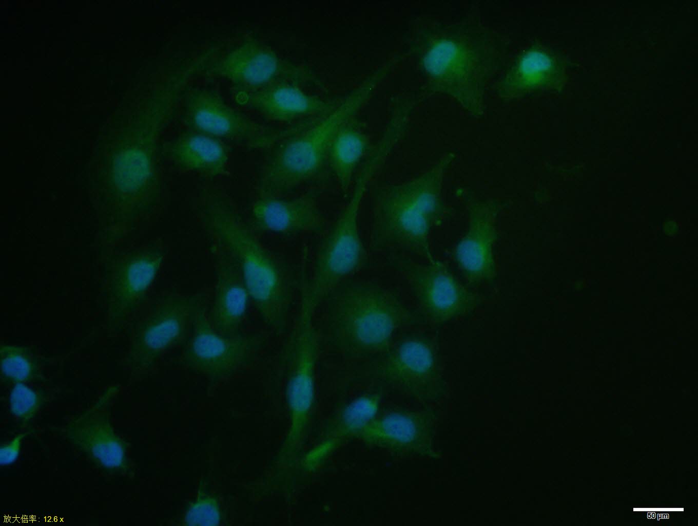 MCF7 cell; 4% Paraformaldehyde-fixed; Triton X-100 at room temperature for 20 min; Blocking buffer (normal goat serum, C-0005) at 37°C for 20 min; Antibody incubation with (Thymosin Alpha-1) polyclonal Antibody, Unconjugated (bs-0026R) 1:100, 90 minutes at 37°C; followed by a conjugated Goat Anti-Rabbit IgG antibody at 37°C for 90 minutes, DAPI (blue, C02-04002) was used to stain the cell nuclei.