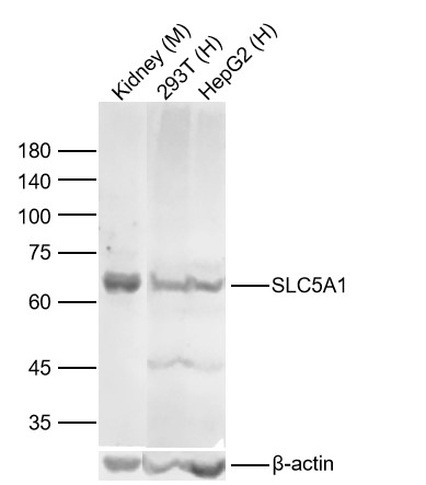 Lane 1: Mouse Kidney Lysates; Lane 2: Human 293T cell Lysates; Lane 3: Human HepG2 cell Lysates. Probed with SLC5A1 polyclonal Antibody, unconjugated (bs-1128R) at 1:1000 dilution and 4°C overnight incubation. Followed by conjugated secondary antibody incubation at 1:20000 for 60 min at 37˚C.