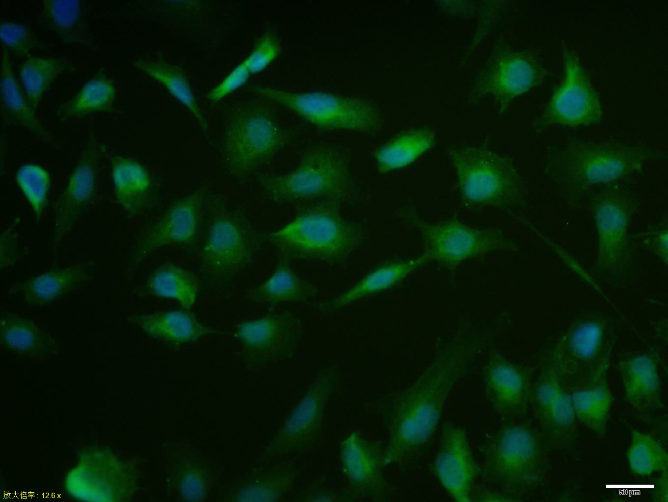 MCF7 cell; 4% Paraformaldehyde-fixed; Triton X-100 at room temperature for 20 min; Blocking buffer (normal goat serum, C-0005) at 37°C for 20 min; Antibody incubation with (MUC1) polyclonal Antibody, Unconjugated (bs-1497R) 1:100, 90 minutes at 37°C; followed by a conjugated Goat Anti-Rabbit IgG antibody at 37°C for 90 minutes, DAPI (blue, C02-04002) was used to stain the cell nuclei.