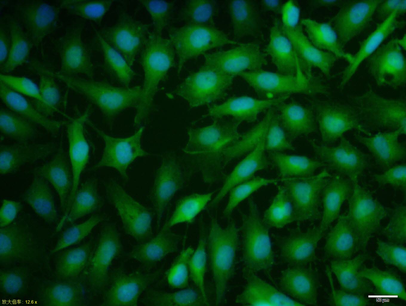 MCF7 cell; 4% Paraformaldehyde-fixed; Triton X-100 at room temperature for 20 min; Blocking buffer (normal goat serum, C-0005) at 37°C for 20 min; Antibody incubation with (Estrogen Receptor alpha) polyclonal Antibody, Unconjugated (bs-2098R) 1:100, 90 minutes at 37°C; followed by a conjugated Goat Anti-Rabbit IgG antibody at 37°C for 90 minutes, DAPI (blue, C02-04002) was used to stain the cell nuclei.