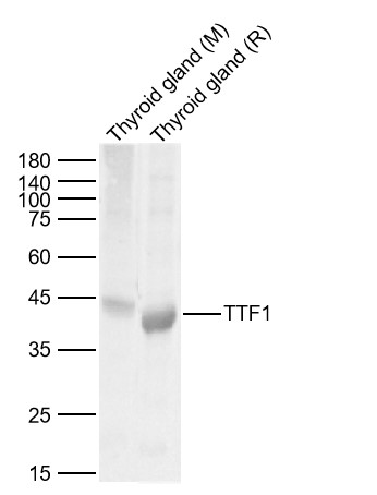 Lane 1: Mouse Thyroid gland Lysates; Lane 2: Rat Thyroid gland Lysates. Probed with TTF1 polyclonal Antibody, unconjugated (bs-0826R) at 1:1000 dilution and 4°C overnight incubation. Followed by conjugated secondary antibody incubation at 1:20000 for 60 min at 37˚C.