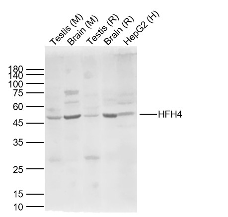 Lane 1: Mouse Testis Lysates; Lane 2: Mouse Brain Lysates; Lane 3: Rat Testis Lysates; Lane 4: Rat Brain Lysates; Lane 5: Human HepG2 cell Lysates. Probed with HFH4 polyclonal Antibody, unconjugated (bs-1775R) at 1:1000 dilution and 4°C overnight incubation. Followed by conjugated secondary antibody incubation at 1:20000 for 60 min at 37˚C. Lane 1: Mouse Testis Lysates; Lane 2: Mouse Brain Lysates; Lane 3: Rat Testis Lysates; Lane 4: Rat Brain Lysates; Lane 5: Human HepG2 cell Lysates. Probed with HFH4 polyclonal Antibody, unconjugated (bs-1775R) at 1:1000 dilution and 4°C overnight incubation. Followed by conjugated secondary antibody incubation at 1:20000 for 60 min at 37˚C.