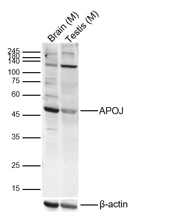 Lane 1: Mouse Brain Lysates; Lane 2: Mouse Testis Lysates. Probed with APOJ polyclonal Antibody, unconjugated (bs-1531R) at 1:1000 dilution and 4°C overnight incubation. Followed by conjugated secondary antibody incubation at 1:20000 for 60 min at 37˚C.