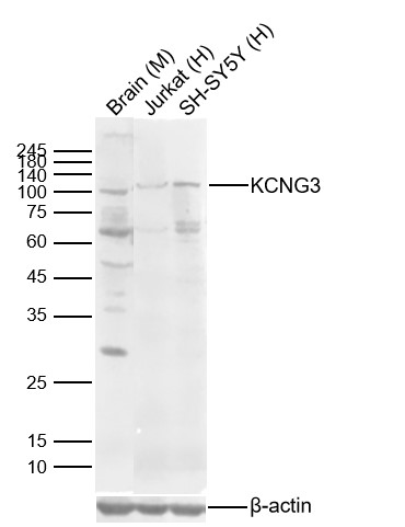 Lane 1: Mouse Brain Lysates; Lane 2: Human Jurkat cell Lysates; Lane 3: Human SH-SY5Y cell Lysates. Probed with KCNG3 polyclonal Antibody, unconjugated (bs-12175R) at 1:1000 dilution and 4°C overnight incubation. Followed by conjugated secondary antibody incubation at 1:20000 for 60 min at 37˚C.