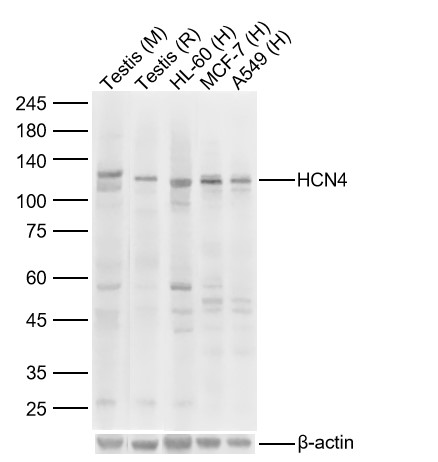 Lane 1: Mouse Testis Lysates; Lane 2: Rat Testis Lysates; Lane 3: Human HL-60 cell Lysates; Lane 4: Human MCF-7 cell Lysates; Lane 5: Human A549 cell Lysates. Probed with HCN4 polyclonal Antibody, unconjugated (bs-1691R) at 1:1000 dilution and 4°C overnight incubation. Followed by conjugated secondary antibody incubation at 1:20000 for 60 min at 37˚C.
