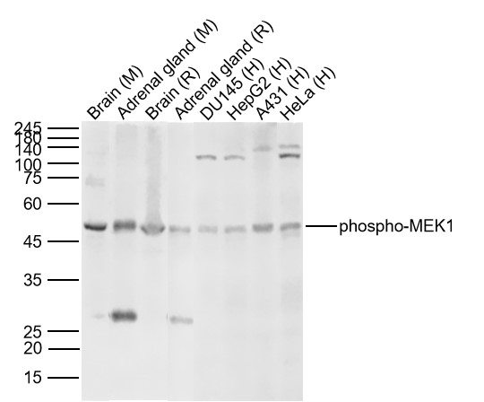 Lane 1: Mouse Brain Lysates; Lane 2: Mouse Adrenal gland Lysates; Lane 3: Rat Brain Lysates; Lane 4: Rat Adrenal gland Lysates; Lane 5: Human DU145 cell Lysates; Lane 6: Human HepG2 cell Lysates; Lane 7: Human A431 cell Lysates; Lane 8: Human HeLa cell Lysates. Probed with phospho-MEK1 (Thr386) polyclonal Antibody, unconjugated (bs-5413R) at 1:1000 dilution and 4°C overnight incubation. Followed by conjugated secondary antibody incubation at 1:20000 for 60 min at 37˚C.