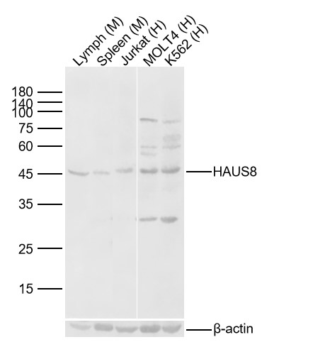 Lane 1: Mouse Lymph Lysates; Lane 2: Mouse SpleenLysates; Lane 3: Human Jurkat cell Lysates; Lane 4: Human MOLT4 cell Lysates; Lane 5: Human K562 cell Lysates. Probed with HAUS8 polyclonal Antibody, unconjugated (bs-9320R) at 1:1000 dilution and 4°C overnight incubation. Followed by conjugated secondary antibody incubation at 1:20000 for 60 min at 37˚C.