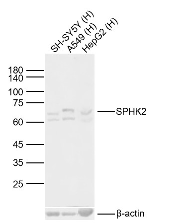 Lane 1: Human SH-SY5Y cell Lysates; Lane 2: Human A549 cell Lysates; Lane 3: Human HepG2 cell Lysates. Probed with SPHK2 polyclonal Antibody, unconjugated (bs-2653R) at 1:1000 dilution and 4°C overnight incubation. Followed by conjugated secondary antibody incubation at 1:20000 for 60 min at 37˚C. Lane 1: Human SH-SY5Y cell Lysates; Lane 2: Human A549 cell Lysates; Lane 3: Human HepG2 cell Lysates. Probed with SPHK2 polyclonal Antibody, unconjugated (bs-2653R) at 1:1000 dilution and 4°C overnight incubation. Followed by conjugated secondary antibody incubation at 1:20000 for 60 min at 37˚C.