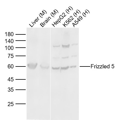 Lane 1: Mouse Liver Lysates; Lane 2: Mouse Brain Lysates; Lane 3: Human HepG2 cell Lysates; Lane 4: Human K562 cell Lysates; Lane 5: Human A549 cell Lysates. Probed with Frizzled 5 polyclonal Antibody, unconjugated (bs-2930R) at 1:1000 dilution and 4°C overnight incubation. Followed by conjugated secondary antibody incubation at 1:20000 for 60 min at 37˚C.