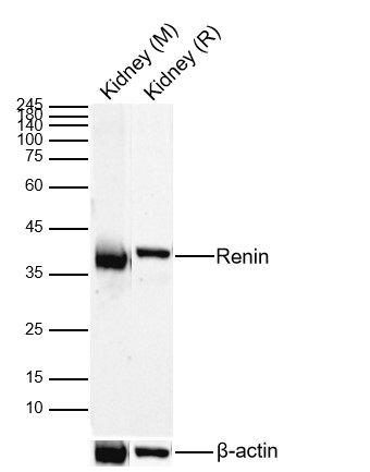 Lane 1: Mouse Kidney Lysates; Lane 2: Rat Kidney Lysates. Probed with Renin polyclonal Antibody, unconjugated (bs-6184R) at 1:1000 dilution and 4°C overnight incubation. Followed by conjugated secondary antibody incubation at 1:20000 for 60 min at 37˚C.