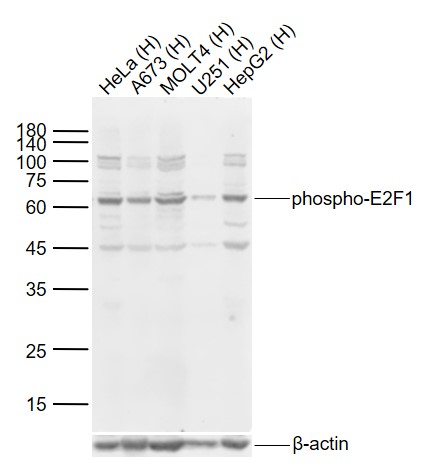Lane 1: Human Hela cell lysates; Lane 2: Human A673 cell lysates; Lane 3: Human Molt-4 cell lysates; Lane 4: Human U251cell lysates; Lane 5: Human HepG2 cell lysates probed with E2F1 (Ser332) Polyclonal Antibody, Unconjugated (bs-5306R) at 1:1000 dilution and 4°C overnight incubation. Followed by conjugated secondary antibody incubation at 1:20000 for 60 min at 37˚C.