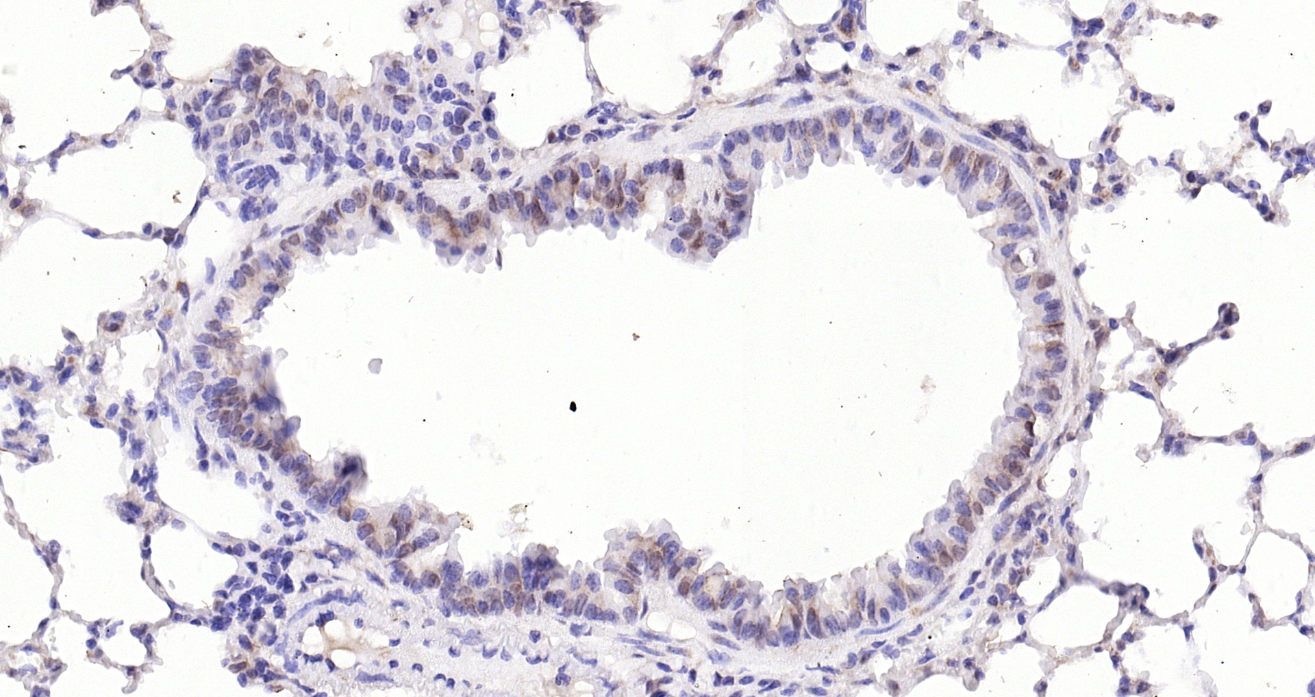 Paraformaldehyde-fixed, paraffin embedded (Mouse lung); Antigen retrieval by boiling in sodium citrate buffer (pH6.0) for 15min; Block endogenous peroxidase by 3% hydrogen peroxide for 20 minutes; Blocking buffer (normal goat serum) at 37°C for 30min; Antibody incubation with (KIBRA) Polyclonal Antibody, Unconjugated (bs-11570R) at 1:200 overnight at 4°C, followed by operating according to SP Kit(Rabbit) (sp-0023) instructionsand DAB staining.