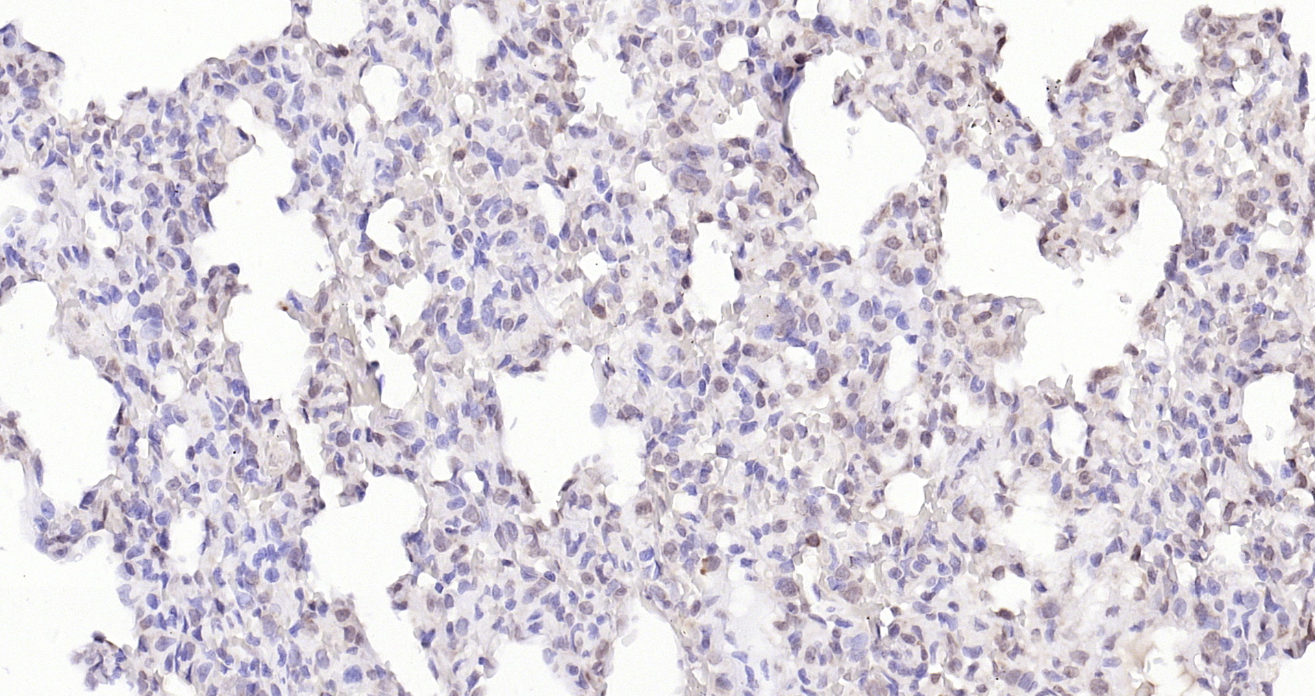 Paraformaldehyde-fixed, paraffin embedded (rat lung); Antigen retrieval by boiling in sodium citrate buffer (pH6.0) for 15min; Block endogenous peroxidase by 3% hydrogen peroxide for 20 minutes; Blocking buffer (normal goat serum) at 37°C for 30min; Antibody incubation with (KIBRA) Polyclonal Antibody, Unconjugated (bs-11570R) at 1:200 overnight at 4°C, followed by operating according to SP Kit(Rabbit) (sp-0023) instructionsand DAB staining.