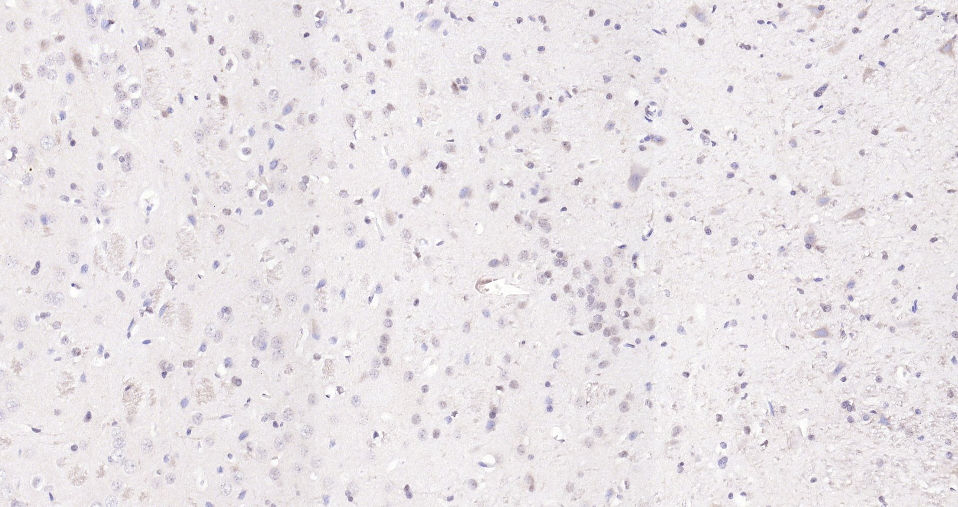 Paraformaldehyde-fixed, paraffin embedded (rat brain); Antigen retrieval by boiling in sodium citrate buffer (pH6.0) for 15min; Block endogenous peroxidase by 3% hydrogen peroxide for 20 minutes; Blocking buffer (normal goat serum) at 37°C for 30min; Antibody incubation with (KIBRA) Polyclonal Antibody, Unconjugated (bs-11570R) at 1:200 overnight at 4°C, followed by operating according to SP Kit(Rabbit) (sp-0023) instructionsand DAB staining.