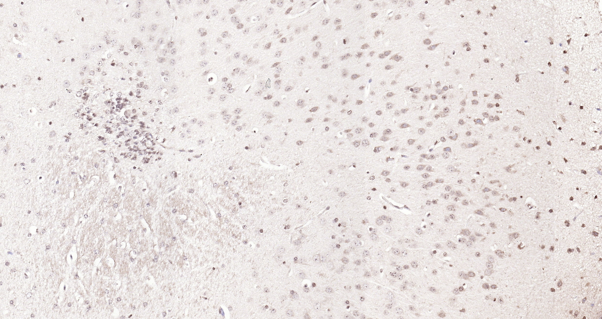 Paraformaldehyde-fixed, paraffin embedded (mouse brain); Antigen retrieval by boiling in sodium citrate buffer (pH6.0) for 15min; Block endogenous peroxidase by 3% hydrogen peroxide for 20 minutes; Blocking buffer (normal goat serum) at 37°C for 30min; Antibody incubation with (KIBRA) Polyclonal Antibody, Unconjugated (bs-11570R) at 1:200 overnight at 4°C, followed by operating according to SP Kit(Rabbit) (sp-0023) instructionsand DAB staining.