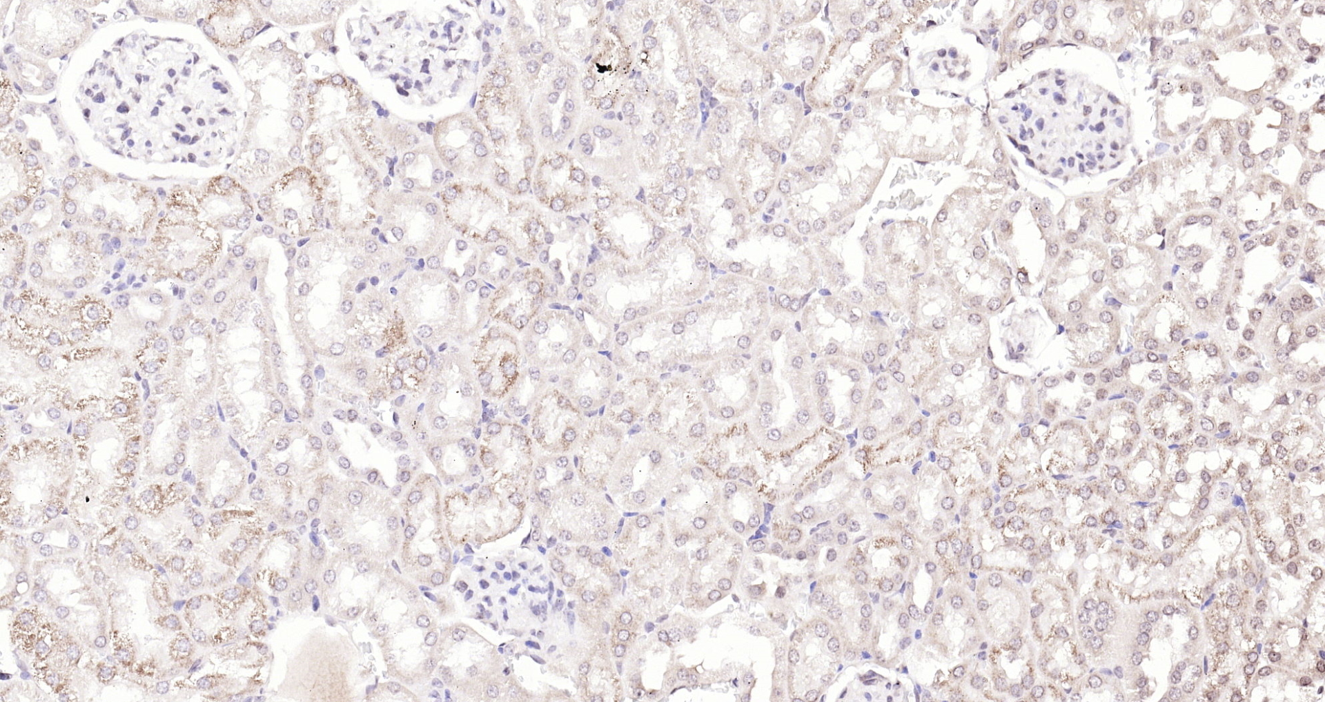 Paraformaldehyde-fixed, paraffin embedded (mouse kidney); Antigen retrieval by boiling in sodium citrate buffer (pH6.0) for 15min; Block endogenous peroxidase by 3% hydrogen peroxide for 20 minutes; Blocking buffer (normal goat serum) at 37°C for 30min; Antibody incubation with (KIBRA) Polyclonal Antibody, Unconjugated (bs-11570R) at 1:200 overnight at 4°C, followed by operating according to SP Kit(Rabbit) (sp-0023) instructionsand DAB staining.