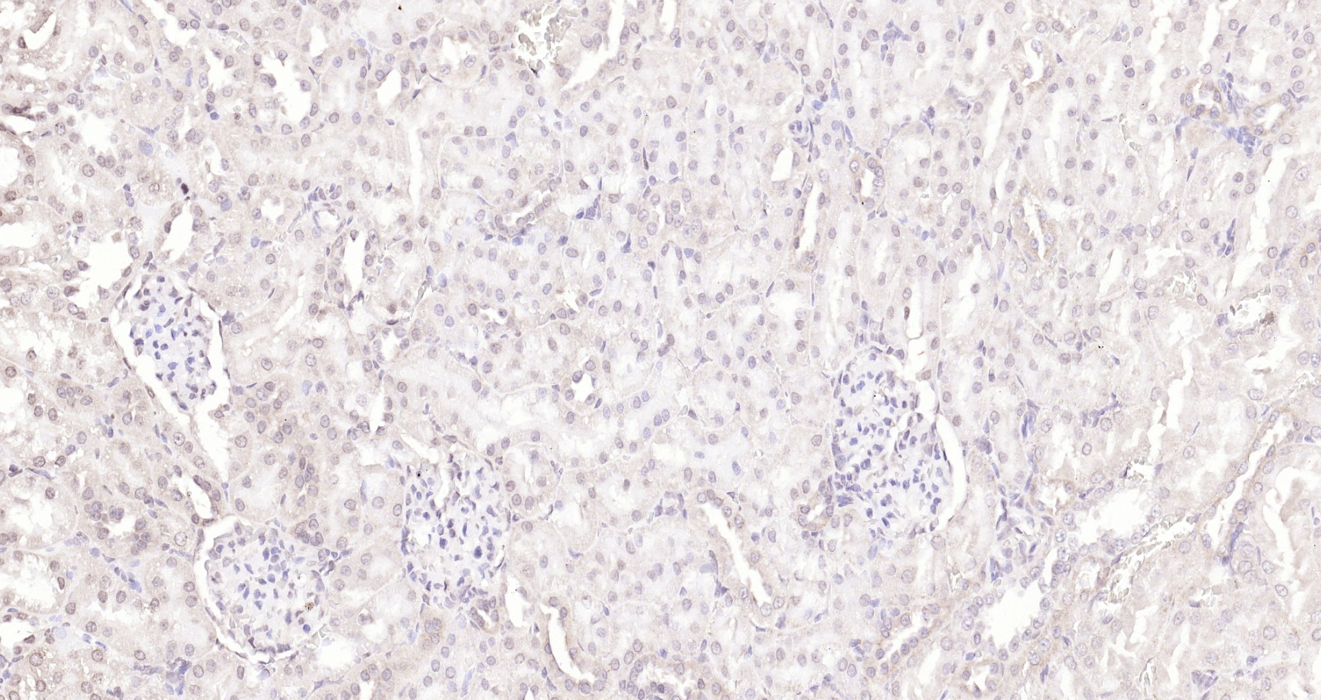 Paraformaldehyde-fixed, paraffin embedded (rat kidney); Antigen retrieval by boiling in sodium citrate buffer (pH6.0) for 15min; Block endogenous peroxidase by 3% hydrogen peroxide for 20 minutes; Blocking buffer (normal goat serum) at 37°C for 30min; Antibody incubation with (KIBRA) Polyclonal Antibody, Unconjugated (bs-11570R) at 1:200 overnight at 4°C, followed by operating according to SP Kit(Rabbit) (sp-0023) instructionsand DAB staining.