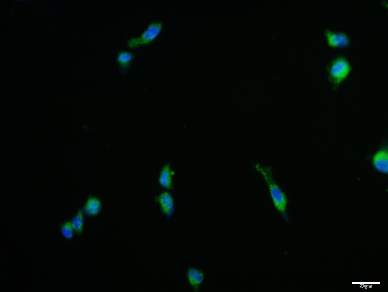U87MG cell; 4% Paraformaldehyde-fixed; Triton X-100 at room temperature for 20 min; Blocking buffer (normal goat serum, C-0005) at 37°C for 20 min; Antibody incubation with (NGFB) polyclonal Antibody, Unconjugated (bs-10806R) 1:100, 90 minutes at 37°C; followed by a conjugated Goat Anti-Rabbit IgG antibody at 37°C for 90 minutes, DAPI (blue, C02-04002) was used to stain the cell nuclei.