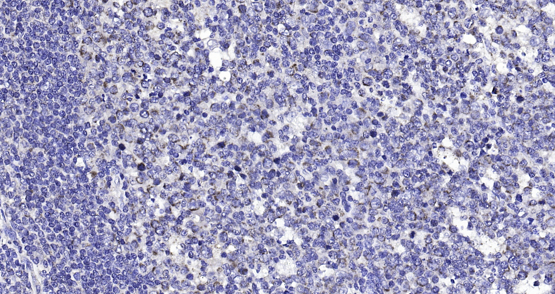 Paraformaldehyde-fixed, paraffin embedded (human tonsil); Antigen retrieval by boiling in sodium citrate buffer (pH6.0) for 15min; Block endogenous peroxidase by 3% hydrogen peroxide for 20 minutes; Blocking buffer (normal goat serum) at 37°C for 30min; Antibody incubation with (Amphiregulin) Polyclonal Antibody, Unconjugated (bs-3847R) at 1:200 overnight at 4°C, followed by operating according to SP Kit(Rabbit) (sp-0023) instructions and DAB staining.