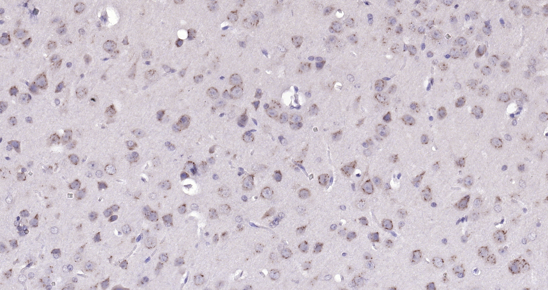 Paraformaldehyde-fixed, paraffin embedded (Mouse brain); Antigen retrieval by boiling in sodium citrate buffer (pH6.0) for 15min; Block endogenous peroxidase by 3% hydrogen peroxide for 20 minutes; Blocking buffer (normal goat serum) at 37°C for 30min; Antibody incubation with (B4GALNT1) Polyclonal Antibody, Unconjugated (bs-12706R) at 1:200 overnight at 4°C, followed by operating according to SP Kit(Rabbit) (sp-0023) instructionsand DAB staining.