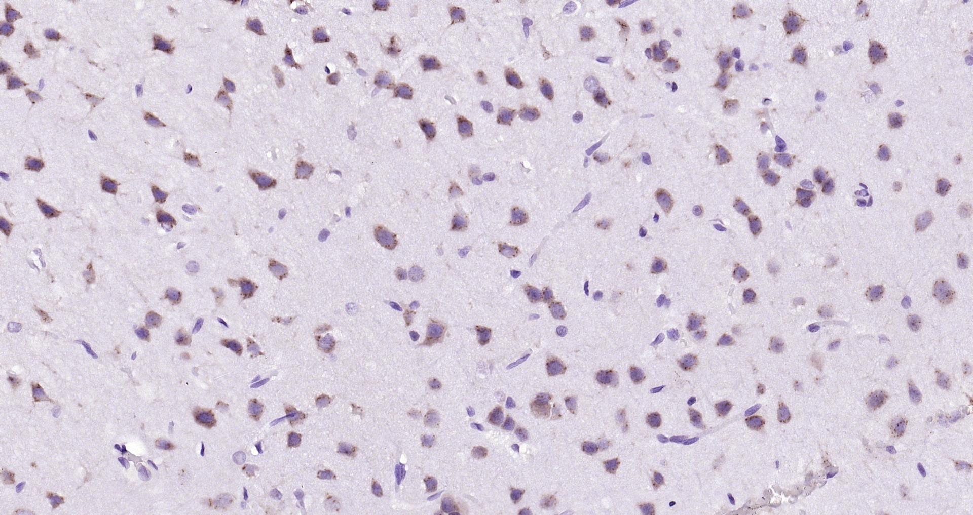Paraformaldehyde-fixed, paraffin embedded (rat brain); Antigen retrieval by boiling in sodium citrate buffer (pH6.0) for 15min; Block endogenous peroxidase by 3% hydrogen peroxide for 20 minutes; Blocking buffer (normal goat serum) at 37°C for 30min; Antibody incubation with (B4GALNT1) Polyclonal Antibody, Unconjugated (bs-12706R) at 1:200 overnight at 4°C, followed by operating according to SP Kit(Rabbit) (sp-0023) instructionsand DAB staining.