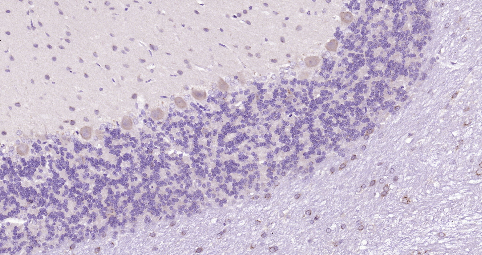 Paraformaldehyde-fixed, paraffin embedded (rat cerebellum); Antigen retrieval by boiling in sodium citrate buffer (pH6.0) for 15min; Block endogenous peroxidase by 3% hydrogen peroxide for 20 minutes; Blocking buffer (normal goat serum) at 37°C for 30min; Antibody incubation with (B4GALNT1) Polyclonal Antibody, Unconjugated (bs-12706R) at 1:200 overnight at 4°C, followed by operating according to SP Kit(Rabbit) (sp-0023) instructionsand DAB staining.