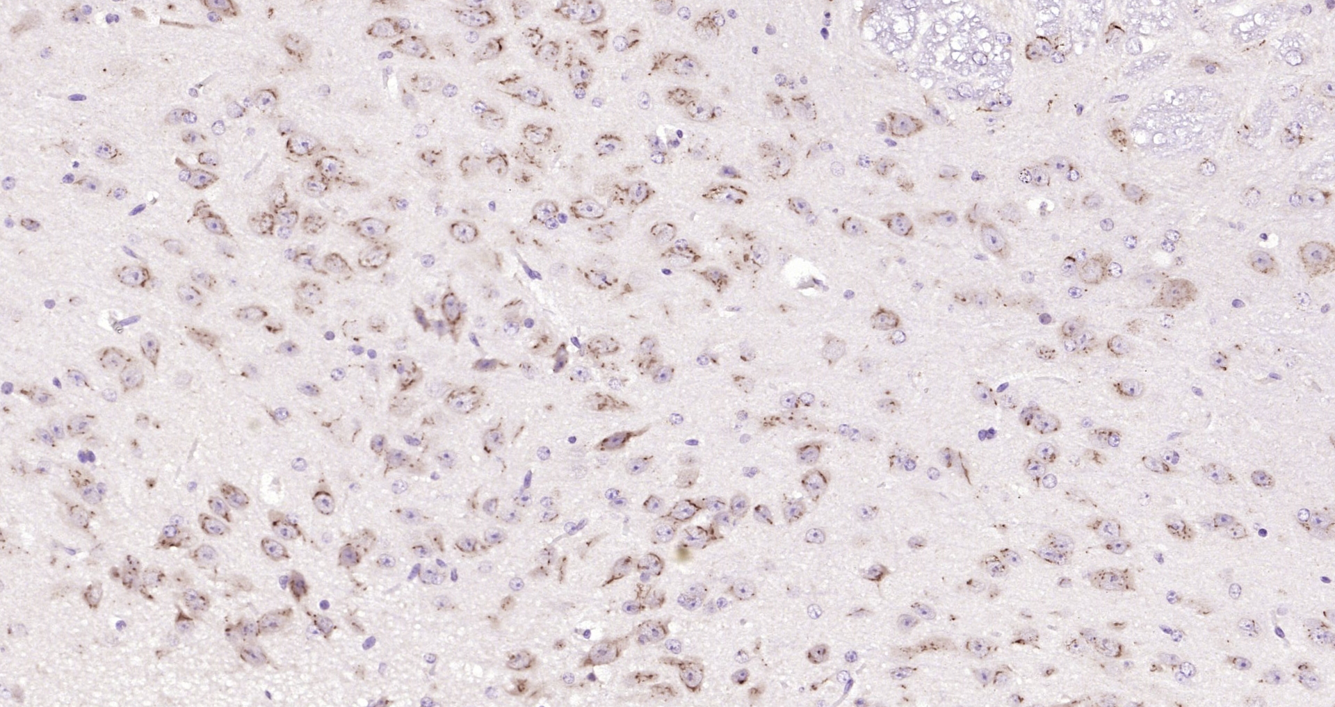 Paraformaldehyde-fixed, paraffin embedded (mouse cerebellum); Antigen retrieval by boiling in sodium citrate buffer (pH6.0) for 15min; Block endogenous peroxidase by 3% hydrogen peroxide for 20 minutes; Blocking buffer (normal goat serum) at 37°C for 30min; Antibody incubation with (B4GALNT1) Polyclonal Antibody, Unconjugated (bs-12706R) at 1:200 overnight at 4°C, followed by operating according to SP Kit(Rabbit) (sp-0023) instructionsand DAB staining.
