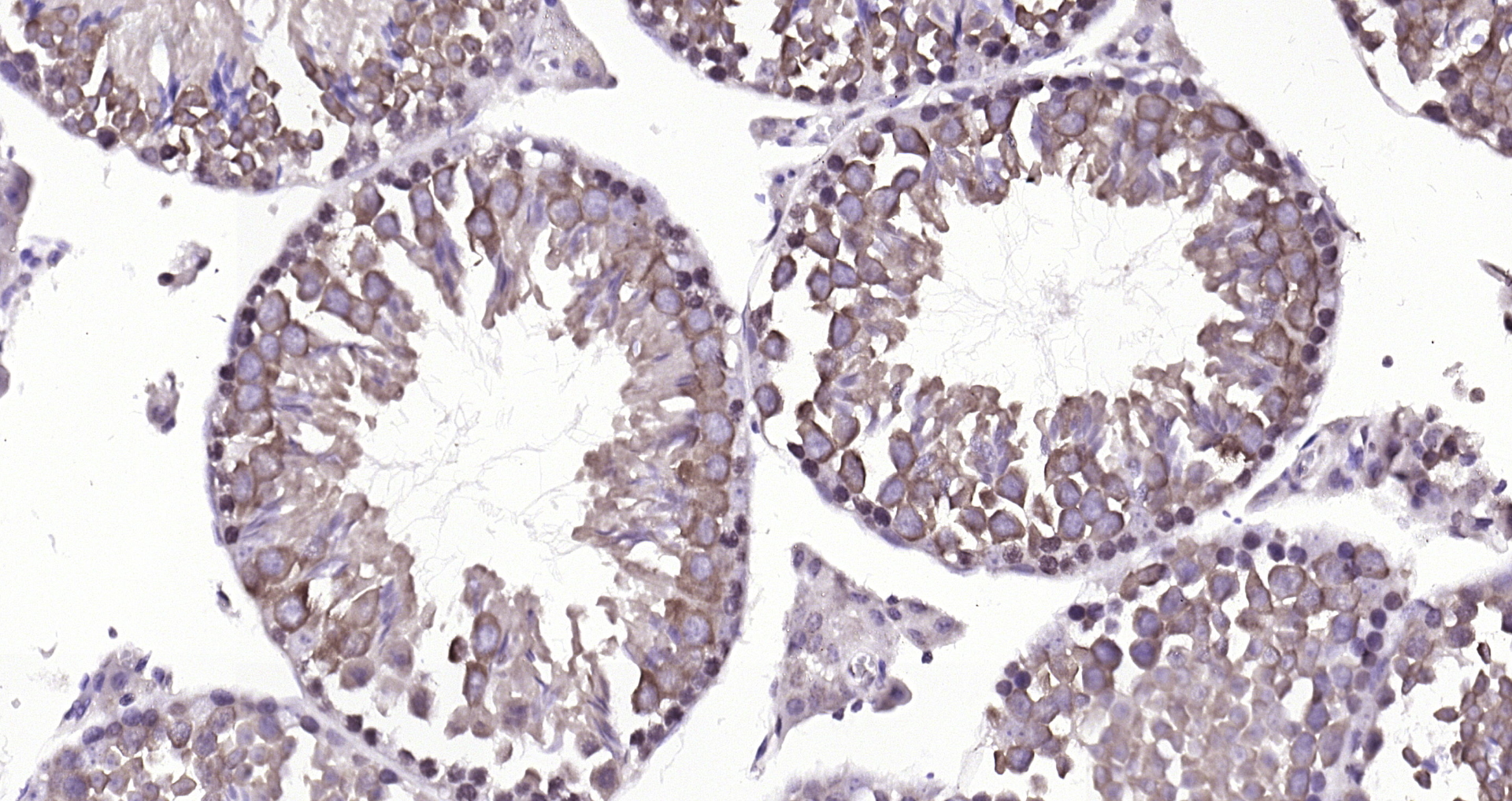 Paraformaldehyde-fixed, paraffin embedded (mouse testis); Antigen retrieval by boiling in sodium citrate buffer (pH6.0) for 15min; Block endogenous peroxidase by 3% hydrogen peroxide for 20 minutes; Blocking buffer (normal goat serum) at 37°C for 30min; Antibody incubation with (DBPA) Polyclonal Antibody, Unconjugated (bs-12985R) at 1:200 overnight at 4°C, followed by operating according to SP Kit(Rabbit) (sp-0023) instructionsand DAB staining.