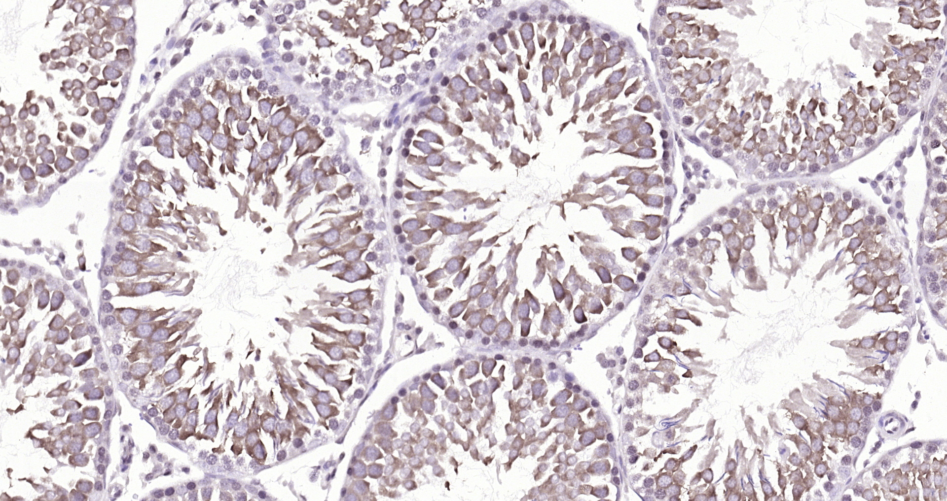 Paraformaldehyde-fixed, paraffin embedded (rat testis); Antigen retrieval by boiling in sodium citrate buffer (pH6.0) for 15min; Block endogenous peroxidase by 3% hydrogen peroxide for 20 minutes; Blocking buffer (normal goat serum) at 37°C for 30min; Antibody incubation with (DBPA) Polyclonal Antibody, Unconjugated (bs-12985R) at 1:200 overnight at 4°C, followed by operating according to SP Kit(Rabbit) (sp-0023) instructionsand DAB staining. Paraformaldehyde-fixed, paraffin embedded (rat testis); Antigen retrieval by boiling in sodium citrate buffer (pH6.0) for 15min; Block endogenous peroxidase by 3% hydrogen peroxide for 20 minutes; Blocking buffer (normal goat serum) at 37°C for 30min; Antibody incubation with (DBPA) Polyclonal Antibody, Unconjugated (bs-12985R) at 1:200 overnight at 4°C, followed by operating according to SP Kit(Rabbit) (sp-0023) instructionsand DAB staining.
