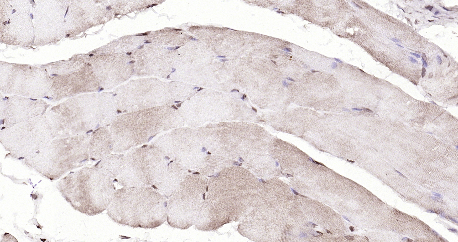 Paraformaldehyde-fixed, paraffin embedded (rat skeletal muscle); Antigen retrieval by boiling in sodium citrate buffer (pH6.0) for 15min; Block endogenous peroxidase by 3% hydrogen peroxide for 20 minutes; Blocking buffer (normal goat serum) at 37°C for 30min; Antibody incubation with (DBPA) Polyclonal Antibody, Unconjugated (bs-12985R) at 1:200 overnight at 4°C, followed by operating according to SP Kit(Rabbit) (sp-0023) instructionsand DAB staining. Paraformaldehyde-fixed, paraffin embedded (rat skeletal muscle); Antigen retrieval by boiling in sodium citrate buffer (pH6.0) for 15min; Block endogenous peroxidase by 3% hydrogen peroxide for 20 minutes; Blocking buffer (normal goat serum) at 37°C for 30min; Antibody incubation with (DBPA) Polyclonal Antibody, Unconjugated (bs-12985R) at 1:200 overnight at 4°C, followed by operating according to SP Kit(Rabbit) (sp-0023) instructionsand DAB staining.