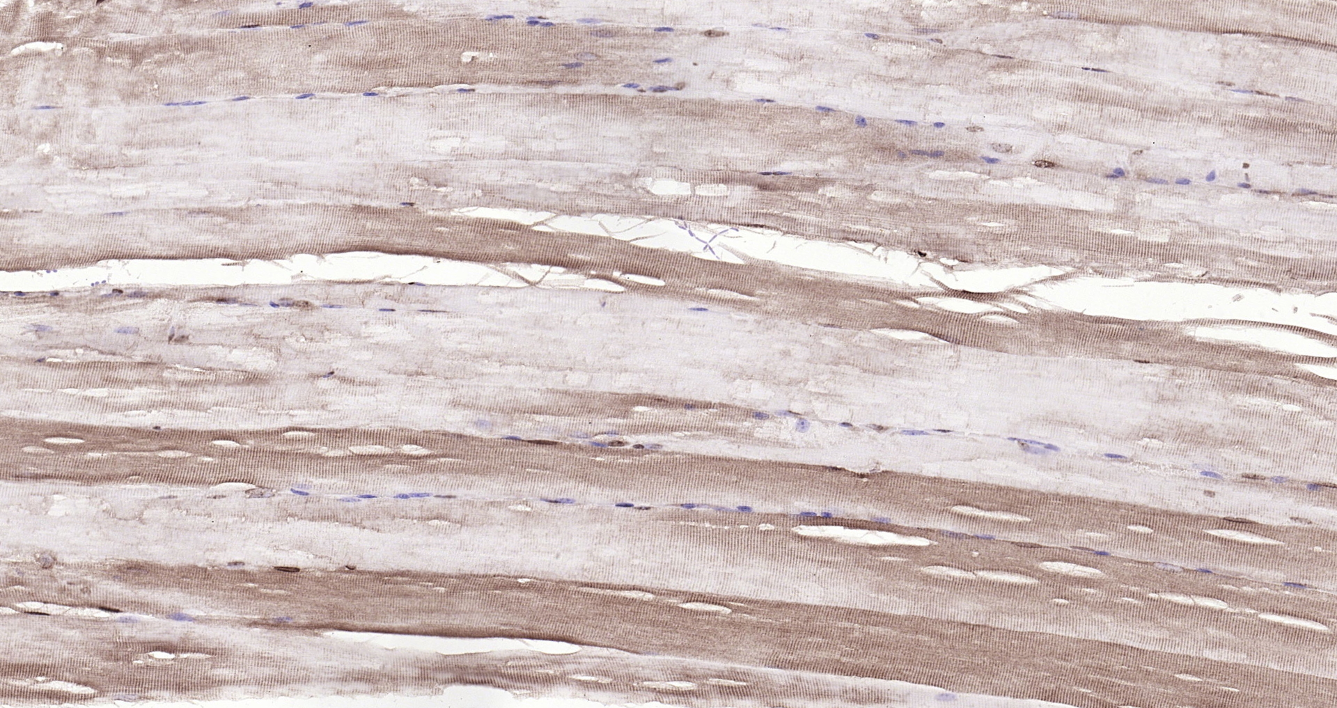 Paraformaldehyde-fixed, paraffin embedded (mouse skeletal muscle); Antigen retrieval by boiling in sodium citrate buffer (pH6.0) for 15min; Block endogenous peroxidase by 3% hydrogen peroxide for 20 minutes; Blocking buffer (normal goat serum) at 37°C for 30min; Antibody incubation with (DBPA) Polyclonal Antibody, Unconjugated (bs-12985R) at 1:200 overnight at 4°C, followed by operating according to SP Kit(Rabbit) (sp-0023) instructionsand DAB staining. Paraformaldehyde-fixed, paraffin embedded (mouse skeletal muscle); Antigen retrieval by boiling in sodium citrate buffer (pH6.0) for 15min; Block endogenous peroxidase by 3% hydrogen peroxide for 20 minutes; Blocking buffer (normal goat serum) at 37°C for 30min; Antibody incubation with (DBPA) Polyclonal Antibody, Unconjugated (bs-12985R) at 1:200 overnight at 4°C, followed by operating according to SP Kit(Rabbit) (sp-0023) instructionsand DAB staining.