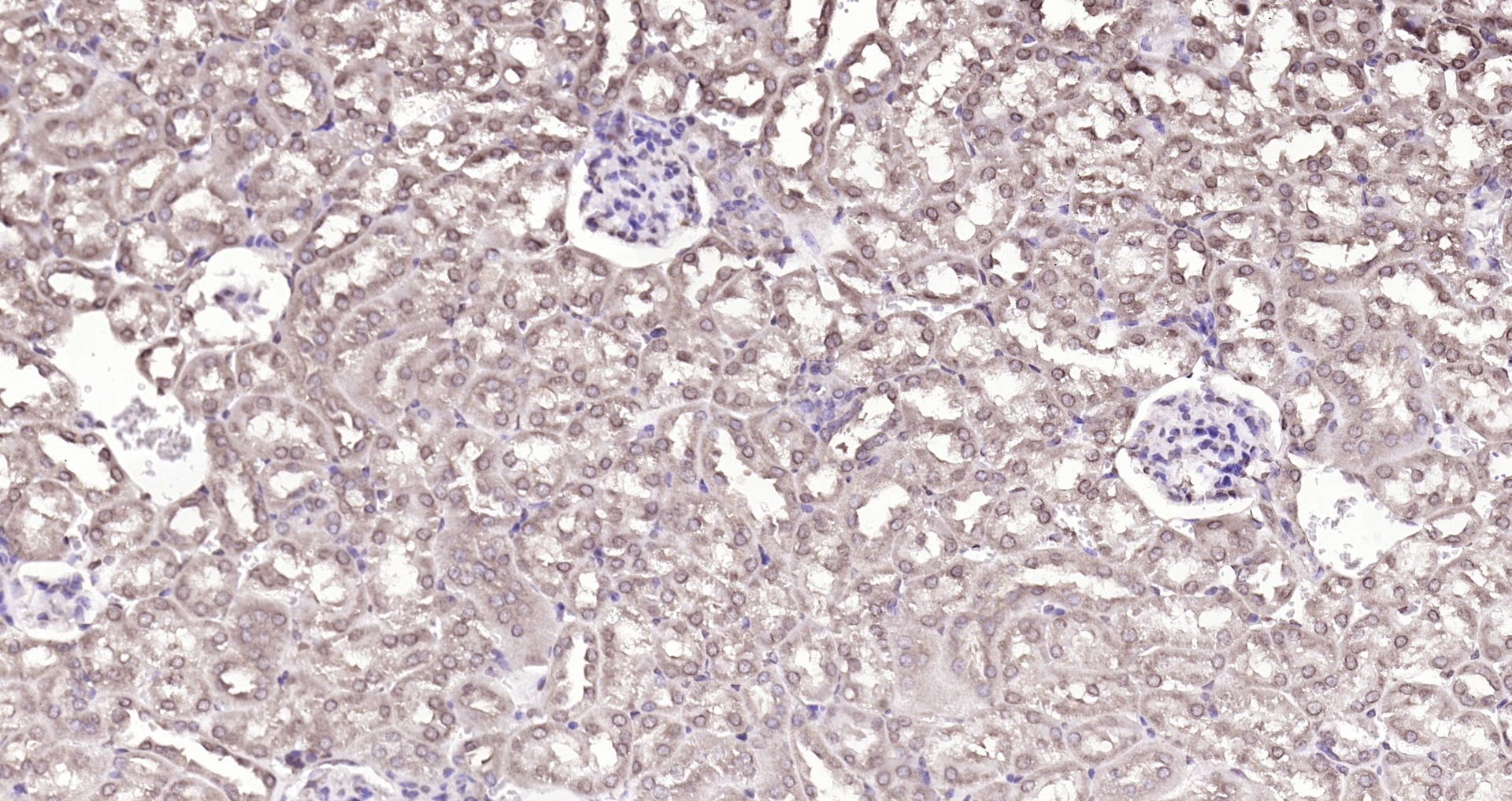 Paraformaldehyde-fixed, paraffin embedded (mouse kidney); Antigen retrieval by boiling in sodium citrate buffer (pH6.0) for 15min; Block endogenous peroxidase by 3% hydrogen peroxide for 20 minutes; Blocking buffer (normal goat serum) at 37°C for 30min; Antibody incubation with (DBPA) Polyclonal Antibody, Unconjugated (bs-12985R) at 1:200 overnight at 4°C, followed by operating according to SP Kit(Rabbit) (sp-0023) instructionsand DAB staining. Paraformaldehyde-fixed, paraffin embedded (mouse kidney); Antigen retrieval by boiling in sodium citrate buffer (pH6.0) for 15min; Block endogenous peroxidase by 3% hydrogen peroxide for 20 minutes; Blocking buffer (normal goat serum) at 37°C for 30min; Antibody incubation with (DBPA) Polyclonal Antibody, Unconjugated (bs-12985R) at 1:200 overnight at 4°C, followed by operating according to SP Kit(Rabbit) (sp-0023) instructionsand DAB staining.