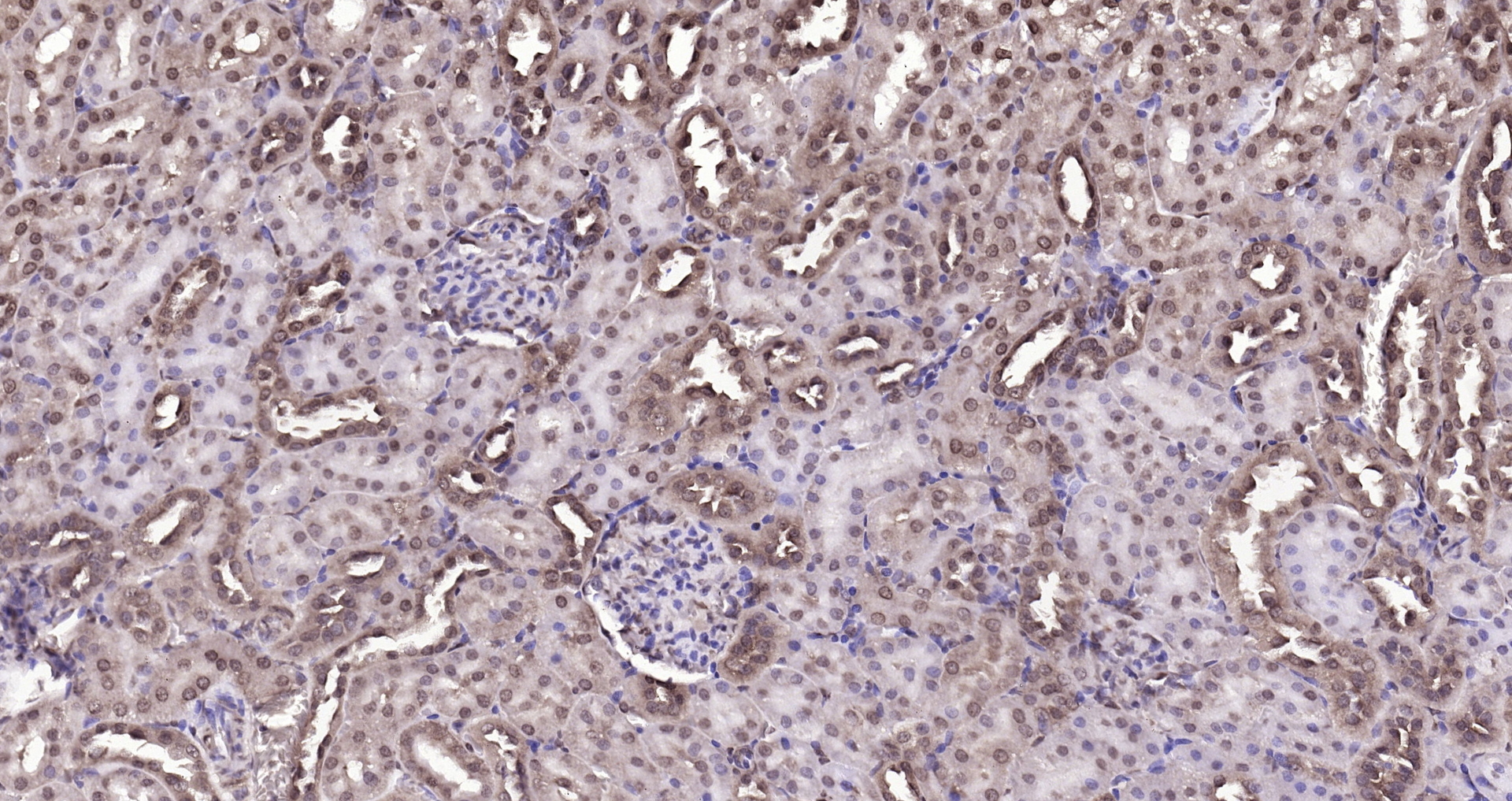 Paraformaldehyde-fixed, paraffin embedded (rat kidney); Antigen retrieval by boiling in sodium citrate buffer (pH6.0) for 15min; Block endogenous peroxidase by 3% hydrogen peroxide for 20 minutes; Blocking buffer (normal goat serum) at 37°C for 30min; Antibody incubation with (DBPA) Polyclonal Antibody, Unconjugated (bs-12985R) at 1:200 overnight at 4°C, followed by operating according to SP Kit(Rabbit) (sp-0023) instructionsand DAB staining. Paraformaldehyde-fixed, paraffin embedded (rat kidney); Antigen retrieval by boiling in sodium citrate buffer (pH6.0) for 15min; Block endogenous peroxidase by 3% hydrogen peroxide for 20 minutes; Blocking buffer (normal goat serum) at 37°C for 30min; Antibody incubation with (DBPA) Polyclonal Antibody, Unconjugated (bs-12985R) at 1:200 overnight at 4°C, followed by operating according to SP Kit(Rabbit) (sp-0023) instructionsand DAB staining.