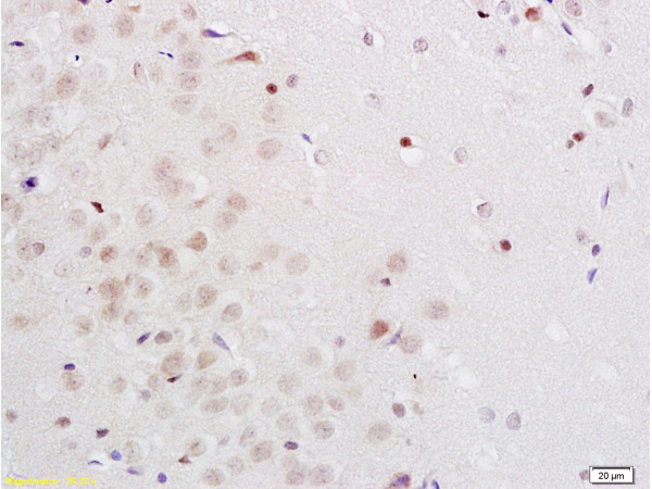 Formalin-fixed and rat brain tissue labeled with Anti-Midnolin Polyclonal Antibody, Unconjugated (bs-0761R) 1:200 followed by conjugation to the secondary antibody and DAB staining