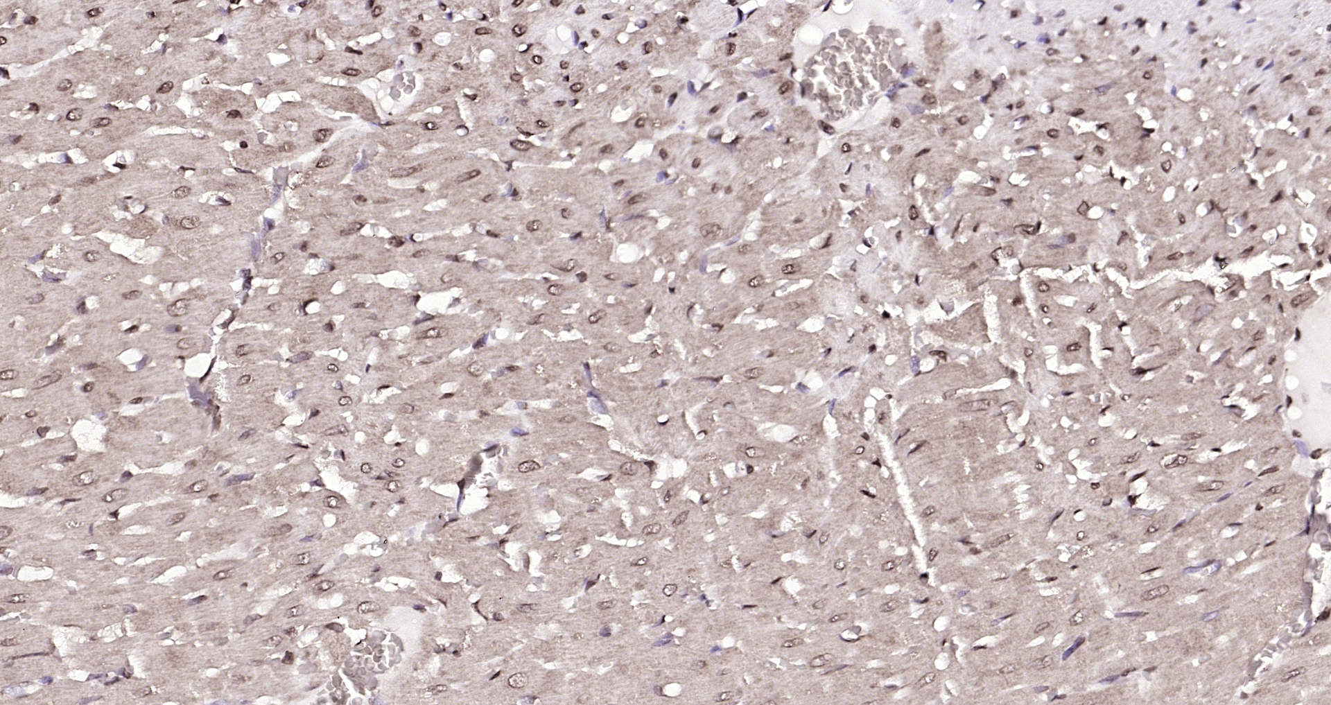 Paraformaldehyde-fixed, paraffin embedded (rat heart); Antigen retrieval by boiling in sodium citrate buffer (pH6.0) for 15min; Block endogenous peroxidase by 3% hydrogen peroxide for 20 minutes; Blocking buffer (normal goat serum) at 37°C for 30min; Antibody incubation with (DBPA) Polyclonal Antibody, Unconjugated (bs-12985R) at 1:200 overnight at 4°C, followed by operating according to SP Kit(Rabbit) (sp-0023) instructionsand DAB staining. Paraformaldehyde-fixed, paraffin embedded (rat heart); Antigen retrieval by boiling in sodium citrate buffer (pH6.0) for 15min; Block endogenous peroxidase by 3% hydrogen peroxide for 20 minutes; Blocking buffer (normal goat serum) at 37°C for 30min; Antibody incubation with (DBPA) Polyclonal Antibody, Unconjugated (bs-12985R) at 1:200 overnight at 4°C, followed by operating according to SP Kit(Rabbit) (sp-0023) instructionsand DAB staining.