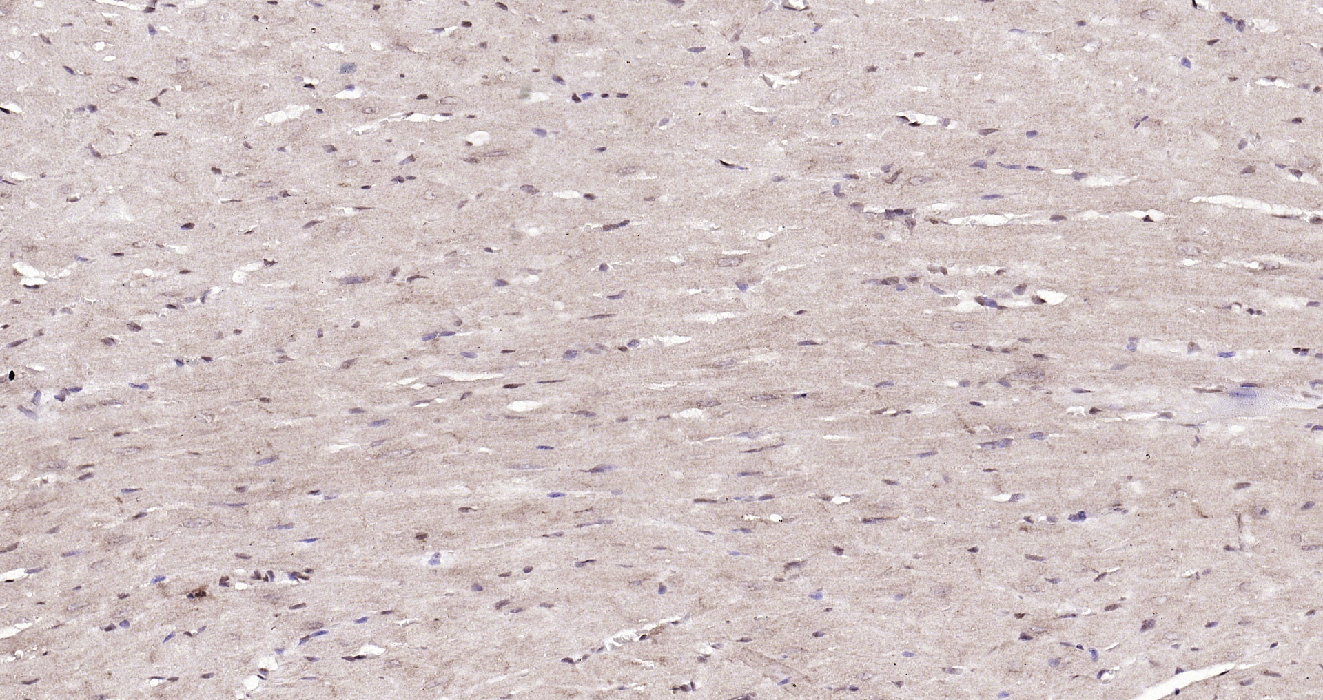 Paraformaldehyde-fixed, paraffin embedded (mouse heart); Antigen retrieval by boiling in sodium citrate buffer (pH6.0) for 15min; Block endogenous peroxidase by 3% hydrogen peroxide for 20 minutes; Blocking buffer (normal goat serum) at 37°C for 30min; Antibody incubation with (DBPA) Polyclonal Antibody, Unconjugated (bs-12985R) at 1:200 overnight at 4°C, followed by operating according to SP Kit(Rabbit) (sp-0023) instructionsand DAB staining. Paraformaldehyde-fixed, paraffin embedded (mouse heart); Antigen retrieval by boiling in sodium citrate buffer (pH6.0) for 15min; Block endogenous peroxidase by 3% hydrogen peroxide for 20 minutes; Blocking buffer (normal goat serum) at 37°C for 30min; Antibody incubation with (DBPA) Polyclonal Antibody, Unconjugated (bs-12985R) at 1:200 overnight at 4°C, followed by operating according to SP Kit(Rabbit) (sp-0023) instructionsand DAB staining.