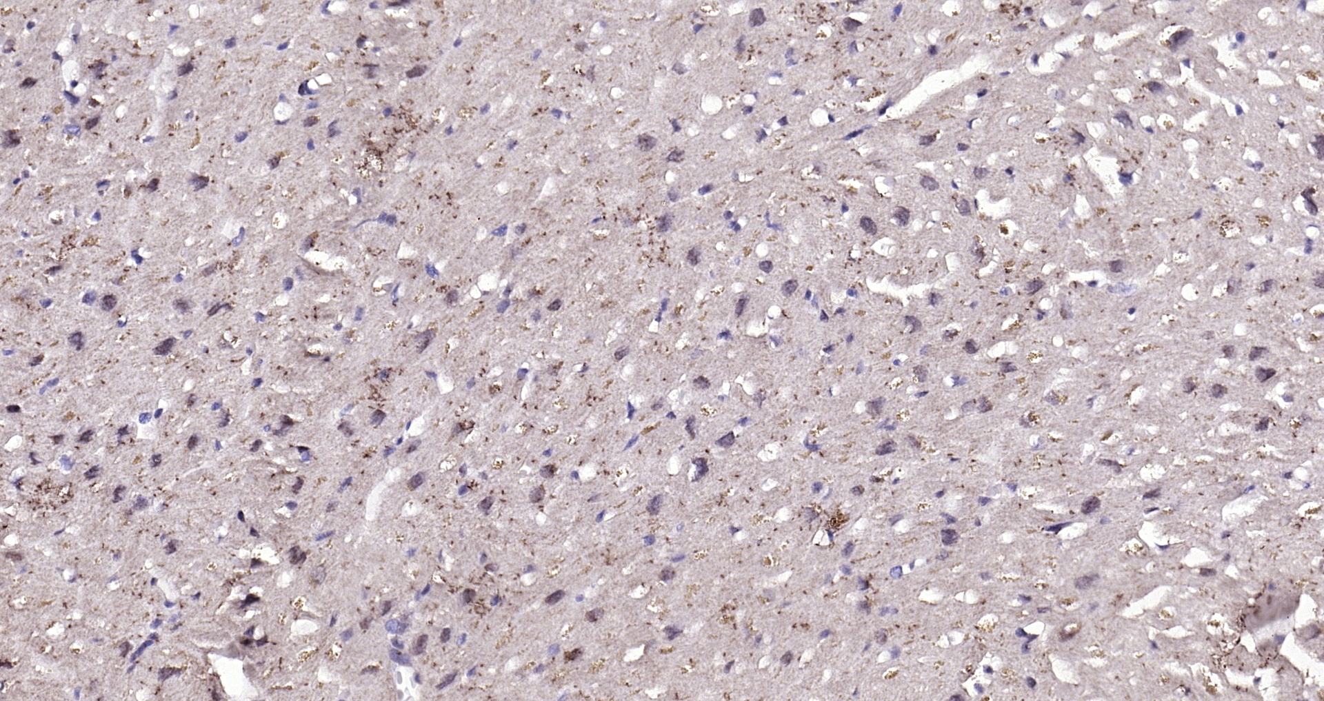 Paraformaldehyde-fixed, paraffin embedded (human heart); Antigen retrieval by boiling in sodium citrate buffer (pH6.0) for 15min; Block endogenous peroxidase by 3% hydrogen peroxide for 20 minutes; Blocking buffer (normal goat serum) at 37°C for 30min; Antibody incubation with (DBPA) Polyclonal Antibody, Unconjugated (bs-12985R) at 1:200 overnight at 4°C, followed by operating according to SP Kit(Rabbit) (sp-0023) instructionsand DAB staining. Paraformaldehyde-fixed, paraffin embedded (human heart); Antigen retrieval by boiling in sodium citrate buffer (pH6.0) for 15min; Block endogenous peroxidase by 3% hydrogen peroxide for 20 minutes; Blocking buffer (normal goat serum) at 37°C for 30min; Antibody incubation with (DBPA) Polyclonal Antibody, Unconjugated (bs-12985R) at 1:200 overnight at 4°C, followed by operating according to SP Kit(Rabbit) (sp-0023) instructionsand DAB staining.