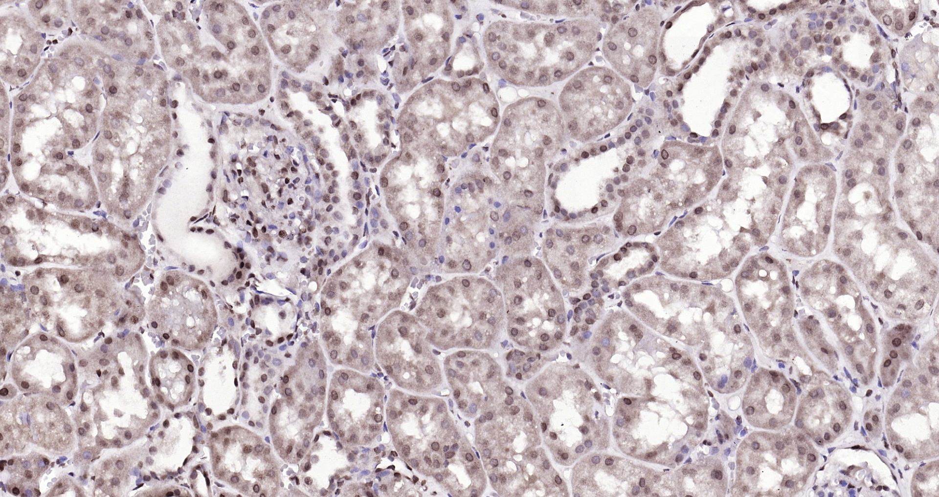 Paraformaldehyde-fixed, paraffin embedded (human kidney); Antigen retrieval by boiling in sodium citrate buffer (pH6.0) for 15min; Block endogenous peroxidase by 3% hydrogen peroxide for 20 minutes; Blocking buffer (normal goat serum) at 37°C for 30min; Antibody incubation with (DBPA) Polyclonal Antibody, Unconjugated (bs-12985R) at 1:200 overnight at 4°C, followed by operating according to SP Kit(Rabbit) (sp-0023) instructionsand DAB staining. Paraformaldehyde-fixed, paraffin embedded (human kidney); Antigen retrieval by boiling in sodium citrate buffer (pH6.0) for 15min; Block endogenous peroxidase by 3% hydrogen peroxide for 20 minutes; Blocking buffer (normal goat serum) at 37°C for 30min; Antibody incubation with (DBPA) Polyclonal Antibody, Unconjugated (bs-12985R) at 1:200 overnight at 4°C, followed by operating according to SP Kit(Rabbit) (sp-0023) instructionsand DAB staining.