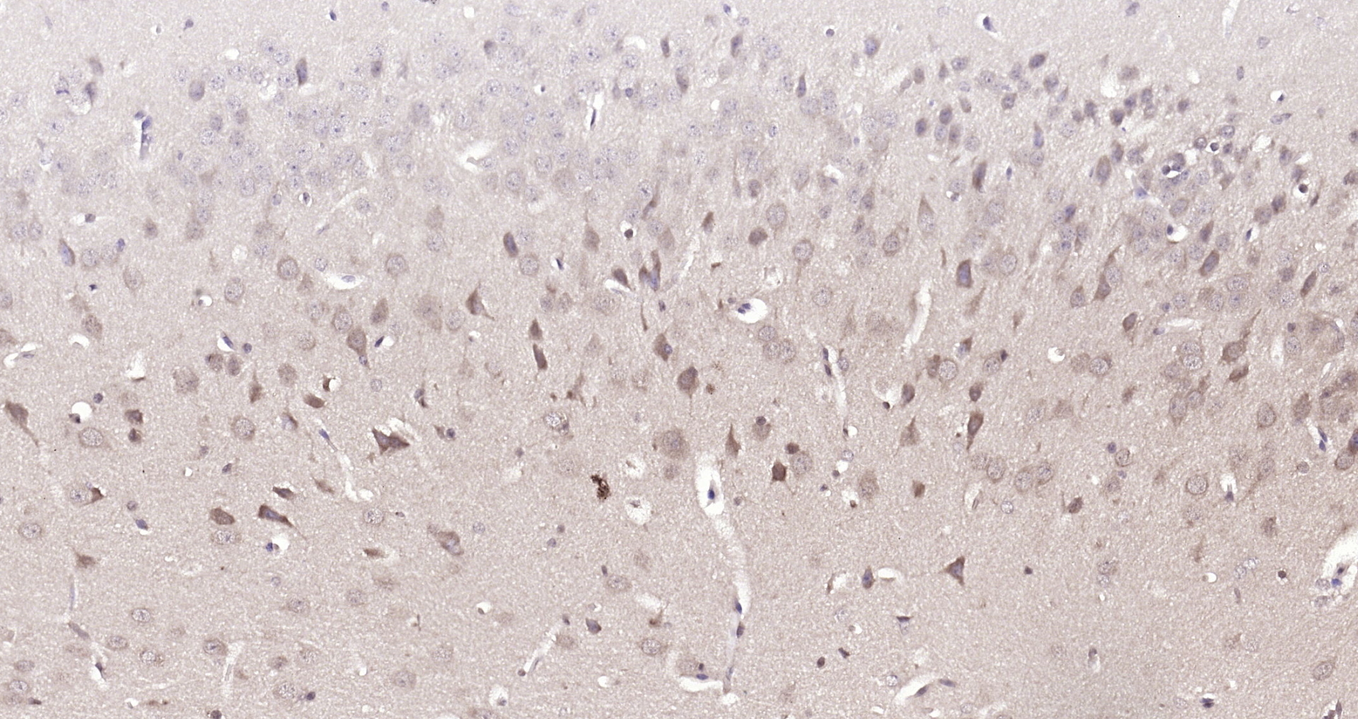 Paraformaldehyde-fixed, paraffin embedded (Mouse brain); Antigen retrieval by boiling in sodium citrate buffer (pH6.0) for 15min; Block endogenous peroxidase by 3% hydrogen peroxide for 20 minutes; Blocking buffer (normal goat serum) at 37°C for 30min; Antibody incubation with (DUSP10) Polyclonal Antibody, Unconjugated (bs-13035R) at 1:200 overnight at 4°C, followed by operating according to SP Kit(Rabbit) (sp-0023) instructionsand DAB staining.